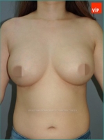 breast