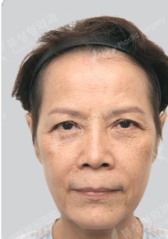 Before — โรงพยาบาลศัลยกรรม วิว