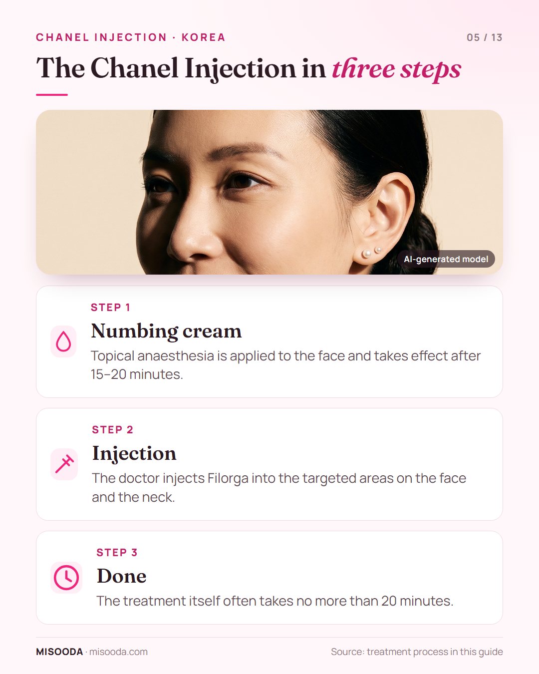Chanel Injection procedure in 3 steps: numbing cream for 15–20 minutes, Filorga injected into the face and neck, treatment done in about 20 minutes