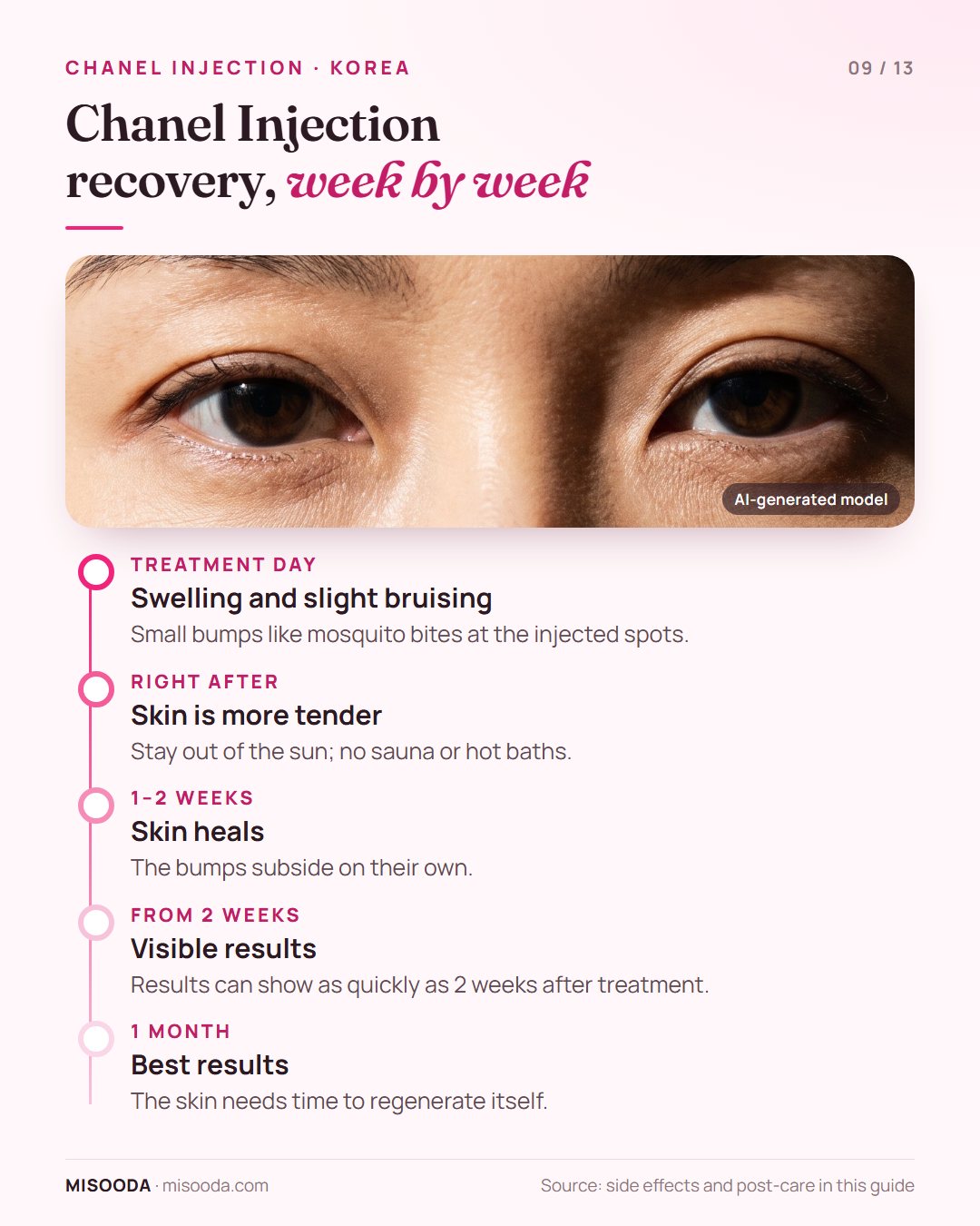 Chanel Injection recovery timeline: swelling and bruising on the day, skin heals in 1–2 weeks, visible results from 2 weeks and best results at 1 month