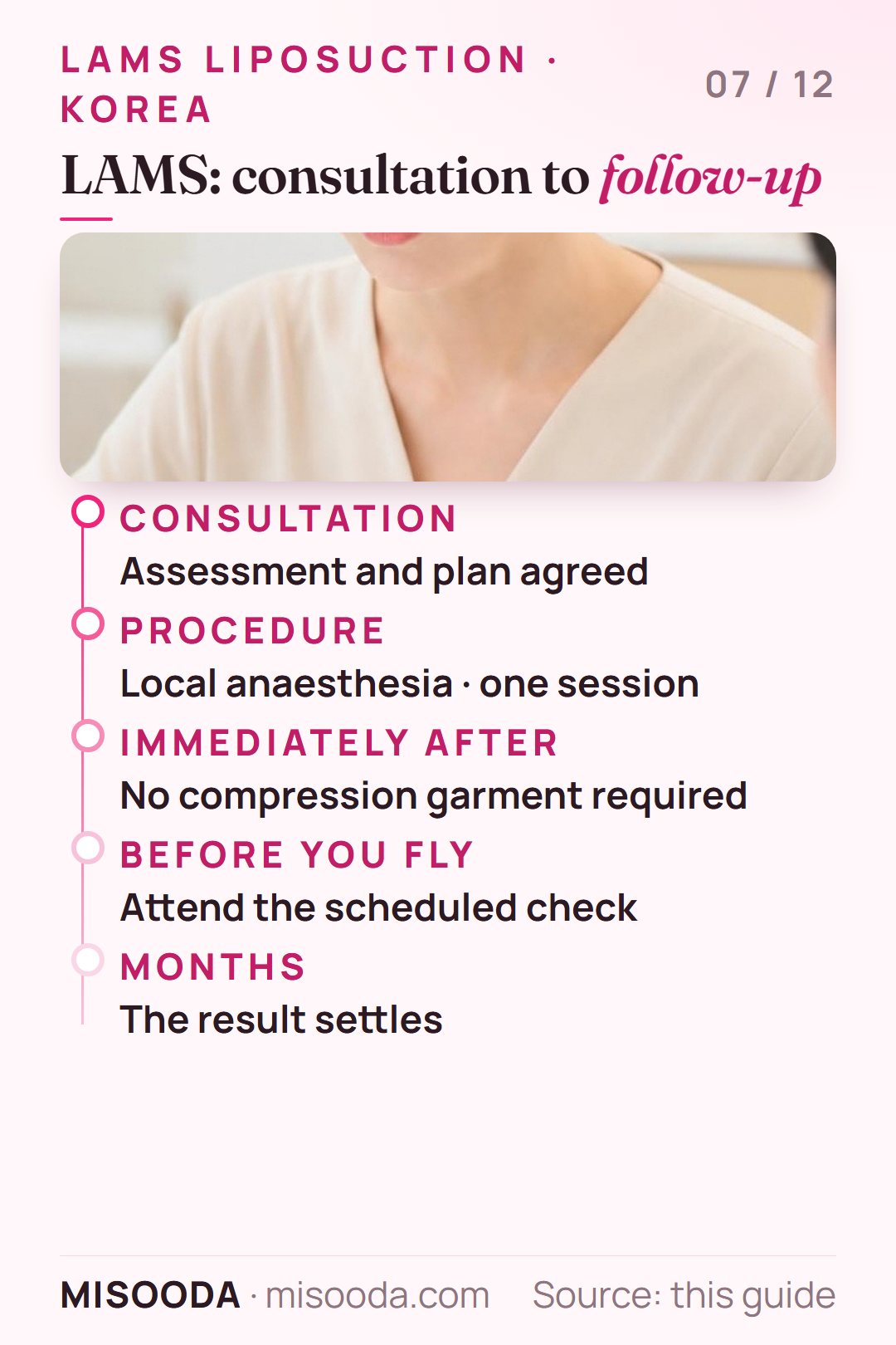 LAMS liposuction journey: consultation and plan, one session under local anaesthesia, no compression garment, follow-up check before flying, result over months