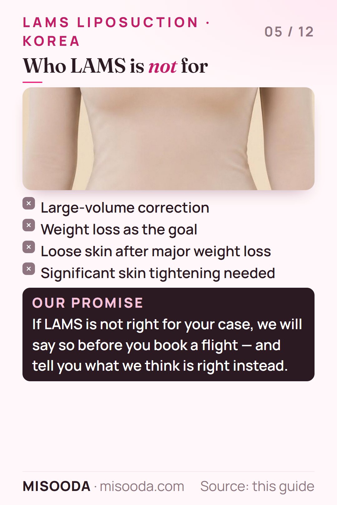Who LAMS liposuction is not for: large-volume correction, weight loss goals, loose skin after major weight loss, or significant skin tightening