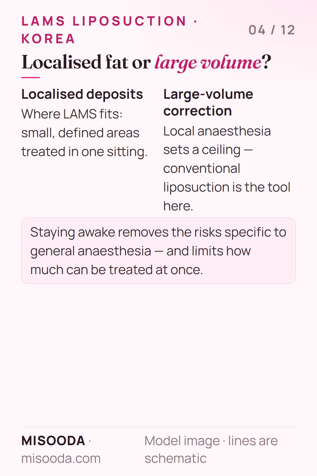 LAMS liposuction suits localised fat deposits; large-volume correction needs conventional liposuction because local anaesthesia limits treatment