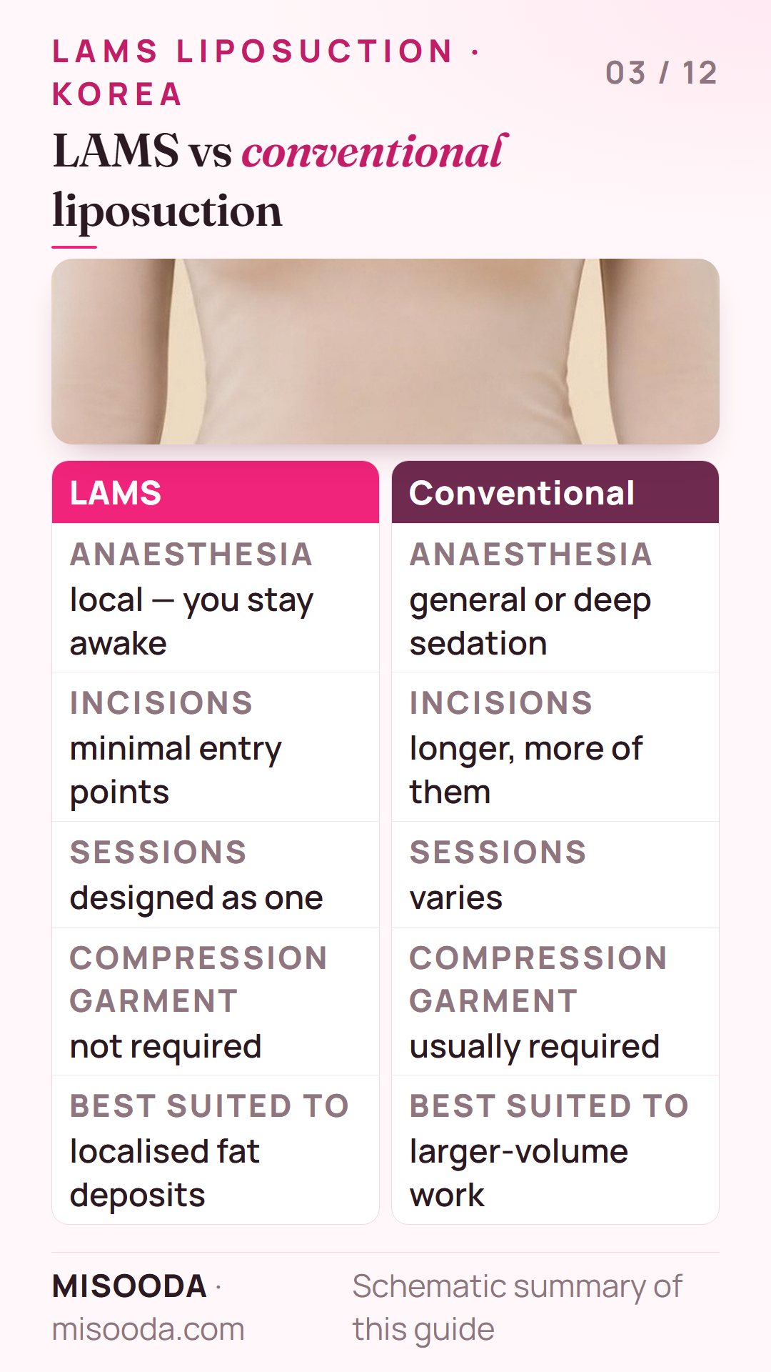 LAMS vs conventional liposuction compared: local vs general anaesthesia or deep sedation, minimal vs longer incisions, garment not required vs usually required