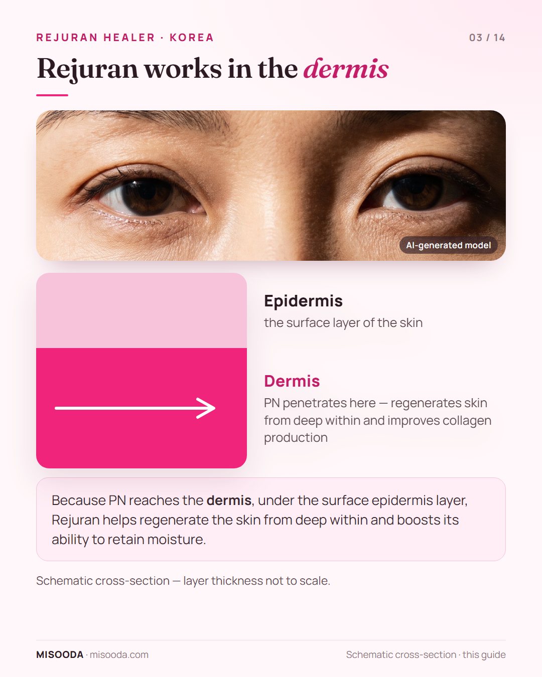 Rejuran polynucleotide penetrates past the epidermis into the dermis layer, where it regenerates skin from deep within and improves collagen production