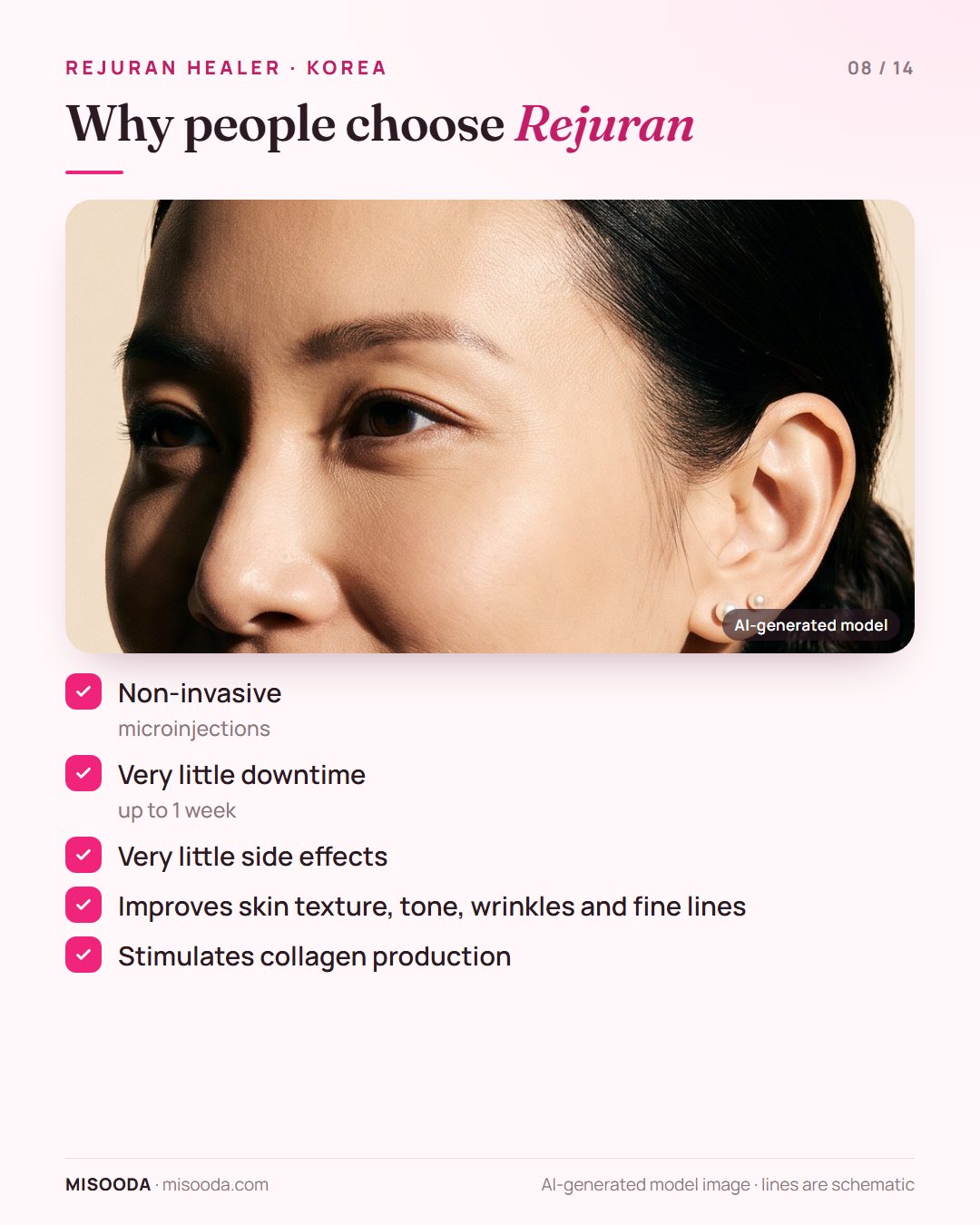 Benefits of Rejuran treatment: non-invasive microinjections, downtime of up to 1 week, few side effects, better texture, tone and fine lines, more collagen