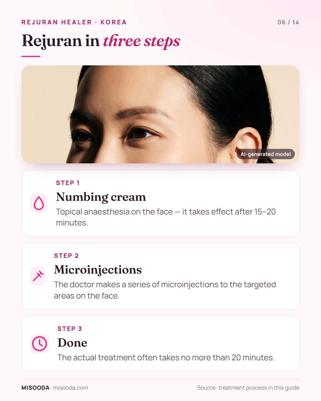 Rejuran Healer procedure in 3 steps: numbing cream for 15–20 minutes, a series of microinjections to target areas, treatment done in about 20 minutes