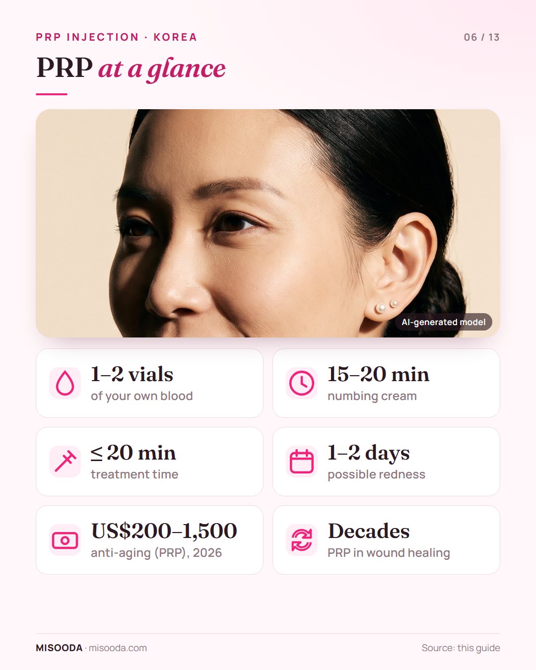 PRP injection key numbers: 1–2 vials of blood, 15–20 minutes of numbing, under 20 minutes of treatment, redness for 1–2 days, US$200–1,500 in Korea