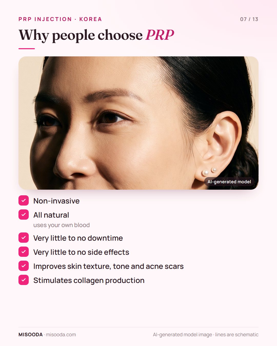 Benefits of PRP treatment in Korea: non-invasive, all natural using your own blood, little to no downtime, improves texture, tone and acne scars, stimulates collagen