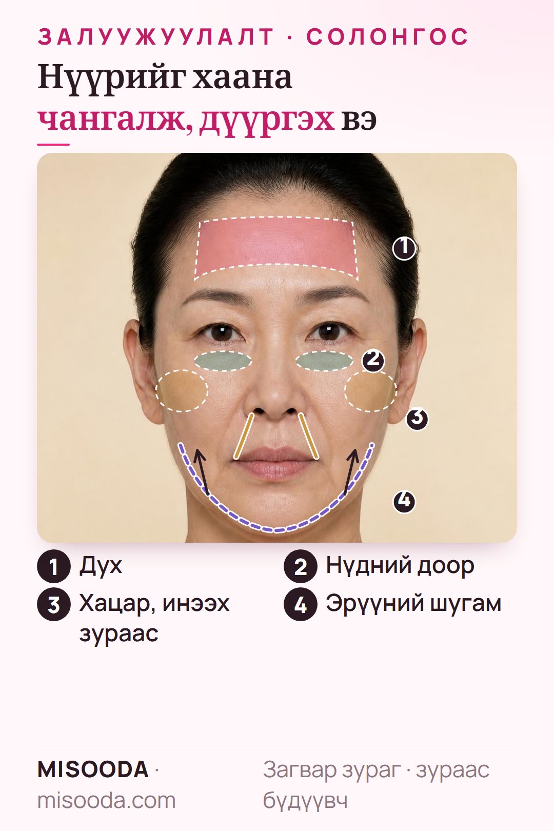 Хөгшрөлтийн эсрэг эмчилгээний хэсгүүд: духны үрчлээ, нүдний доорх хонхор, дүүргэх хацар ба инээх зураас, дээш татаж чангалах эрүүний шугам