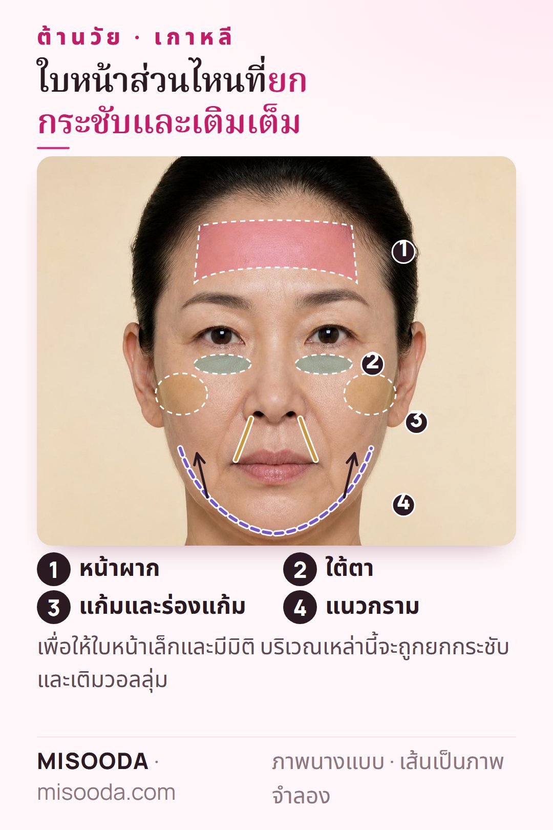 บริเวณทำต้านวัยบนใบหน้า: ริ้วรอยหน้าผาก ร่องใต้ตา แก้มและร่องแก้มที่ต้องเติม และแนวกรามที่ต้องยกกระชับ