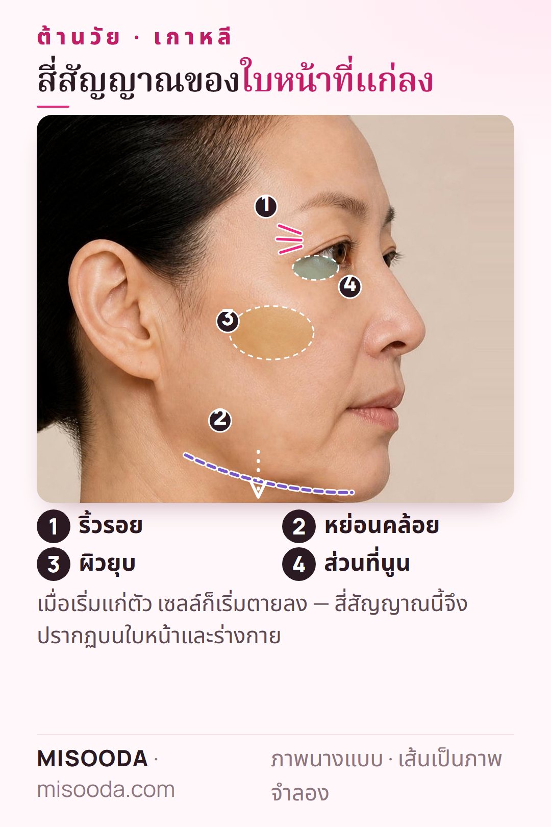 ศัลยกรรมต้านวัย เกาหลี: 4 สัญญาณความแก่หลักบนภาพด้านข้าง — ริ้วรอยรอบดวงตา แนวกรามหย่อน ผิวยุบ และบริเวณที่นูน