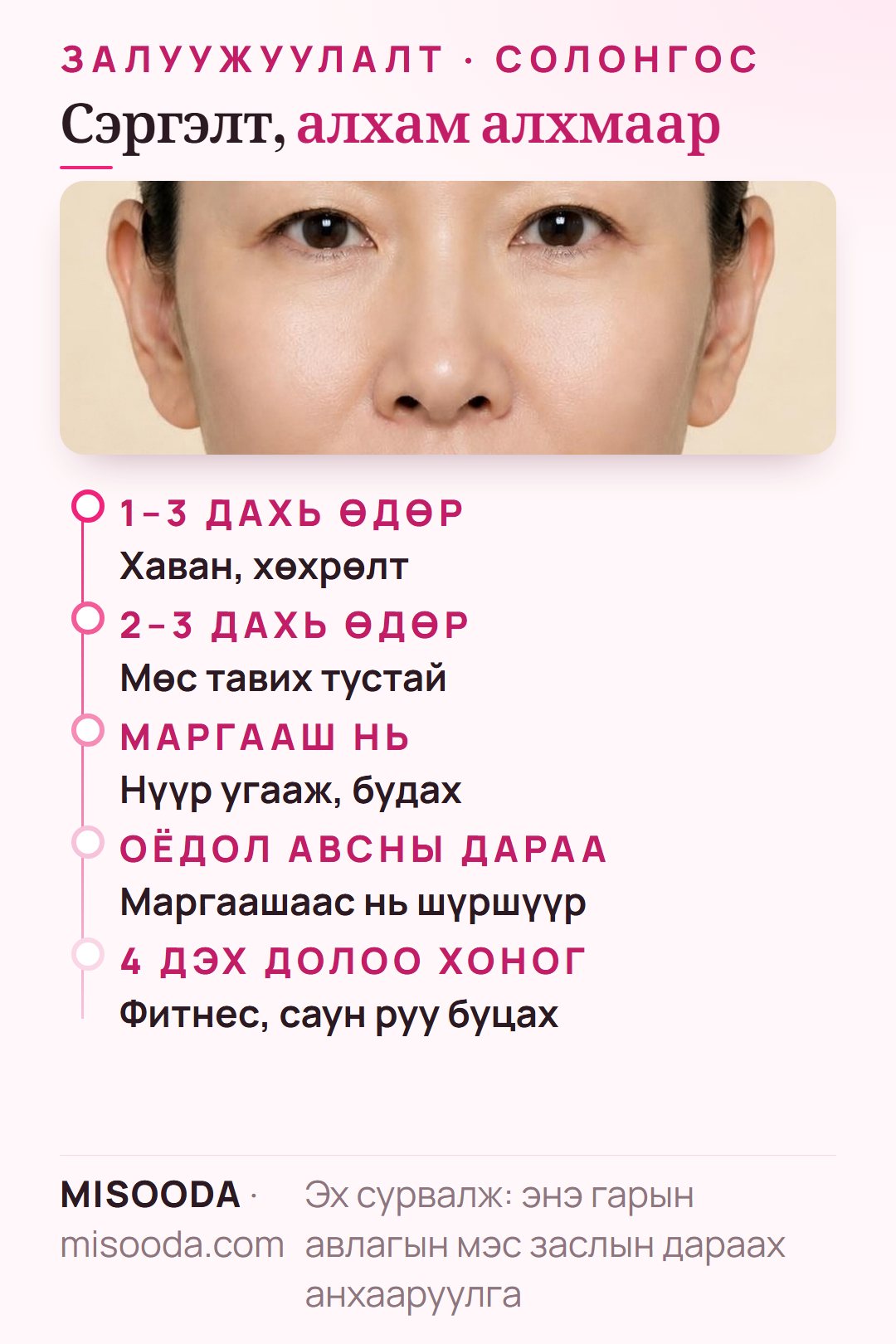Хөгшрөлтийн эсрэг мэс заслын сэргэлт: 3 хоног хаван, хөхрөлт, 2–3 хоног мөс тавих, маргааш нь будаж болно, 4 долоо хоног фитнес, саунгүй