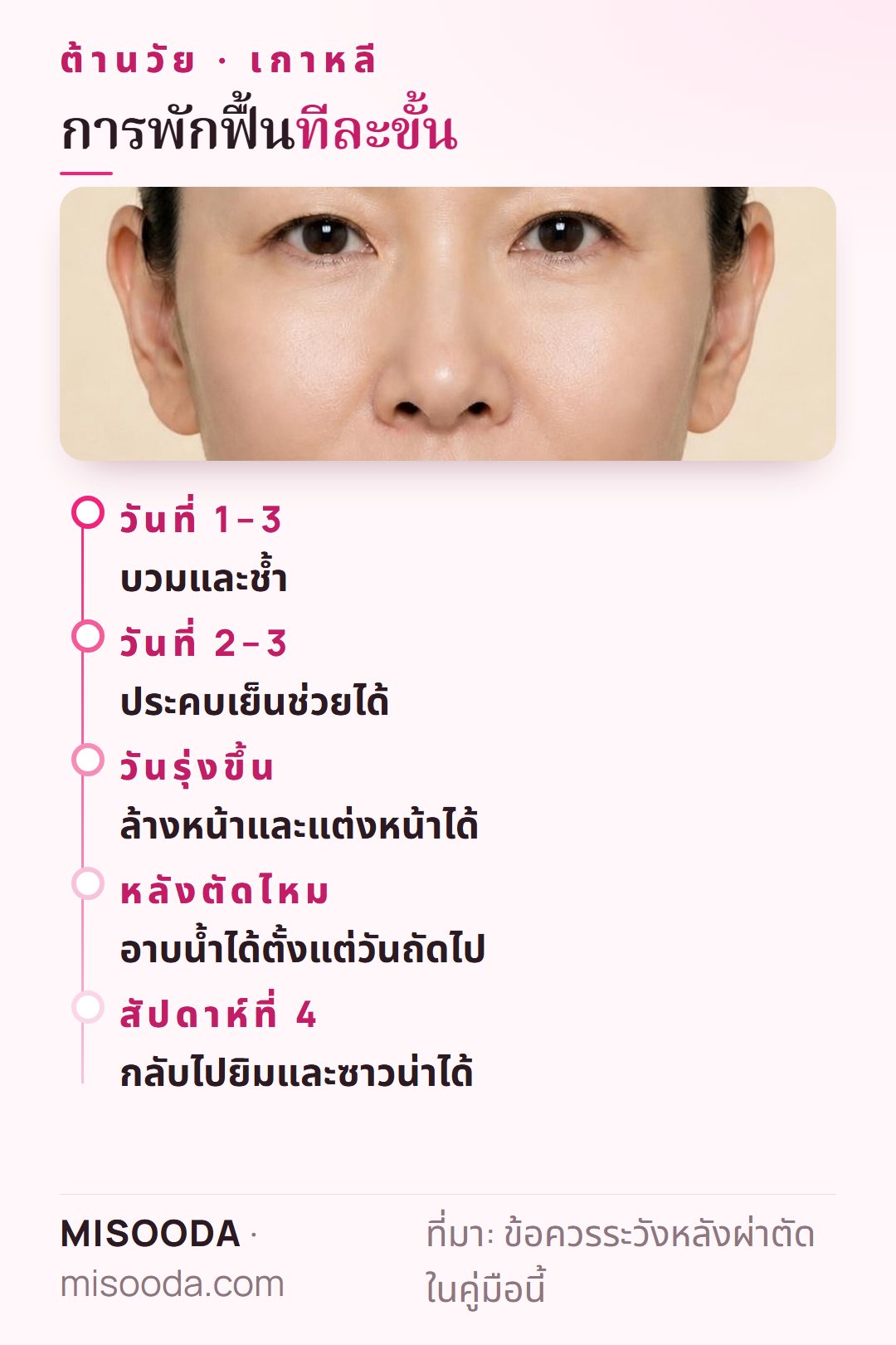 ไทม์ไลน์พักฟื้นศัลยกรรมต้านวัย: บวมช้ำ 3 วัน ประคบเย็น 2–3 วัน แต่งหน้าได้วันรุ่งขึ้น งดยิมหรือซาวน่า 4 สัปดาห์