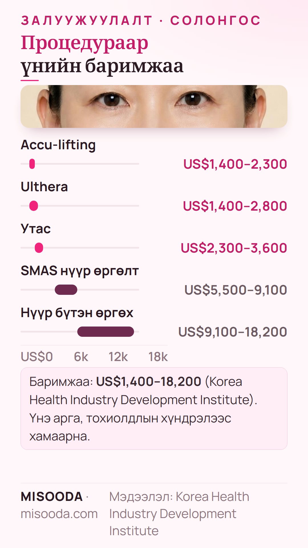 Солонгос дахь хөгшрөлтийн эсрэг мэс заслын үнэ: Ulthera US$1,400–2,800, утас US$2,300–3,600, SMAS нүүр өргөлт US$5,500–9,100, нүүр бүтэн өргөх US$9,100–18,200