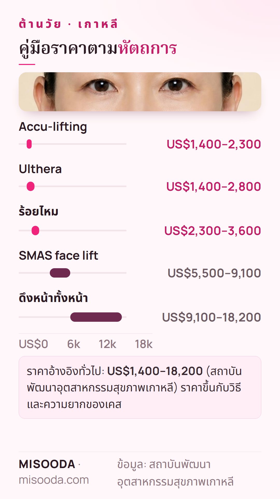 คู่มือราคาศัลยกรรมต้านวัย เกาหลี: Ulthera US$1,400–2,800 ร้อยไหม US$2,300–3,600 SMAS face lift US$5,500–9,100 ดึงหน้าทั้งหน้า US$9,100–18,200