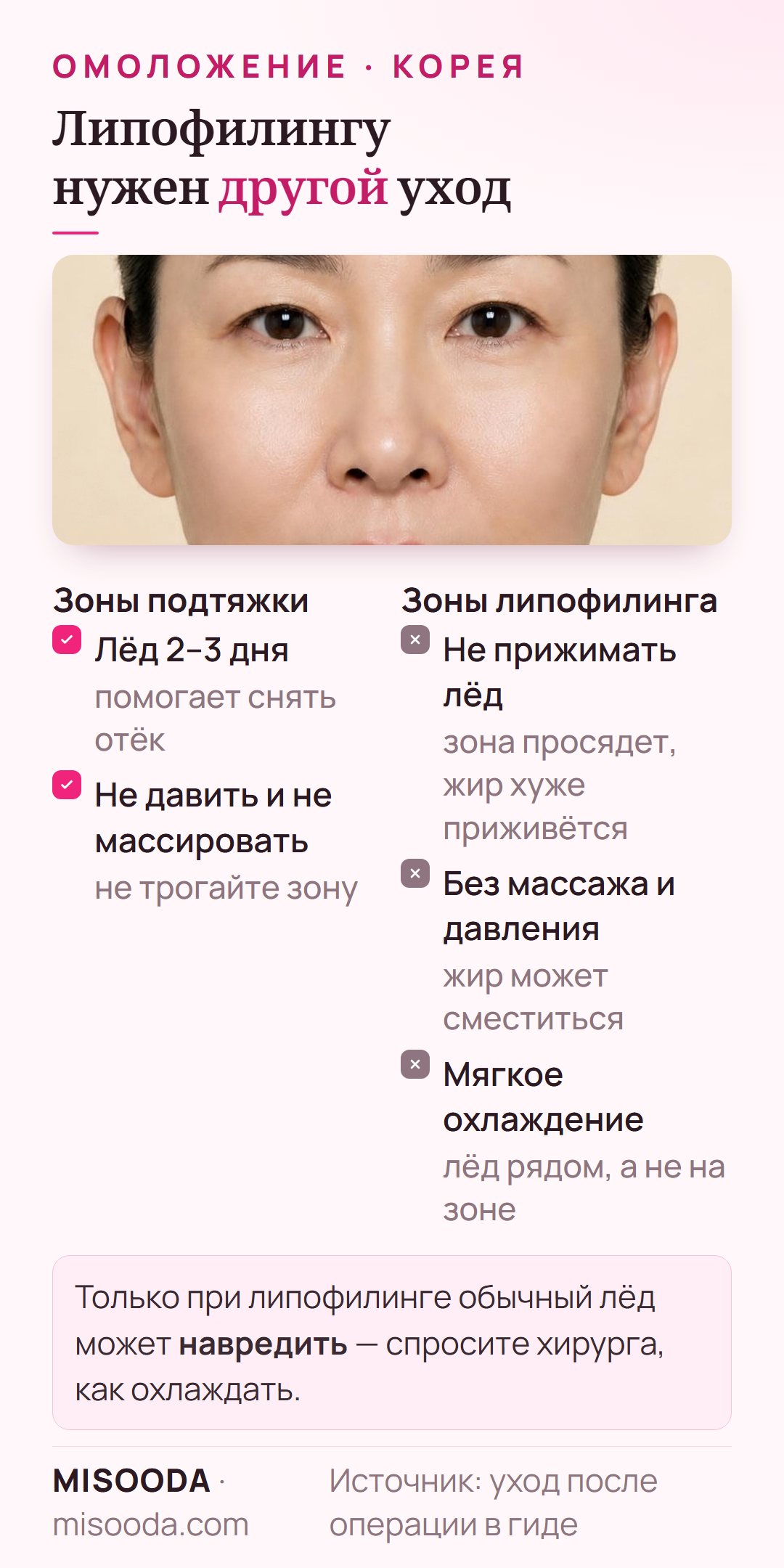 Уход после липофилинга и подтяжки лица: лёд 2–3 дня на зоны подтяжки, но без прижатия льда и массажа на зонах липофилинга, чтобы жир прижился