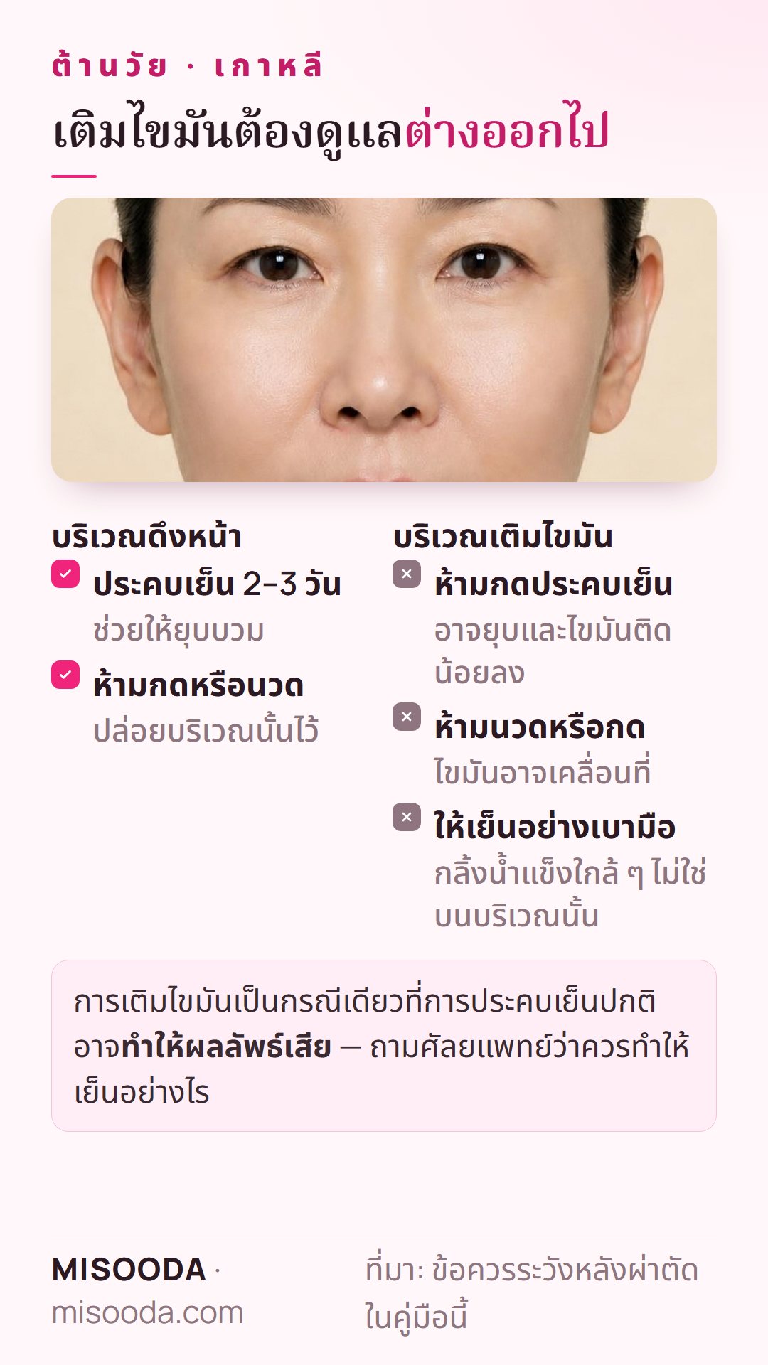 ดูแลหลังเติมไขมันเทียบกับดึงหน้า: ประคบเย็น 2–3 วันบริเวณดึงหน้า แต่ห้ามกดประคบหรือนวดบริเวณเติมไขมันเพื่อให้ไขมันติดดี