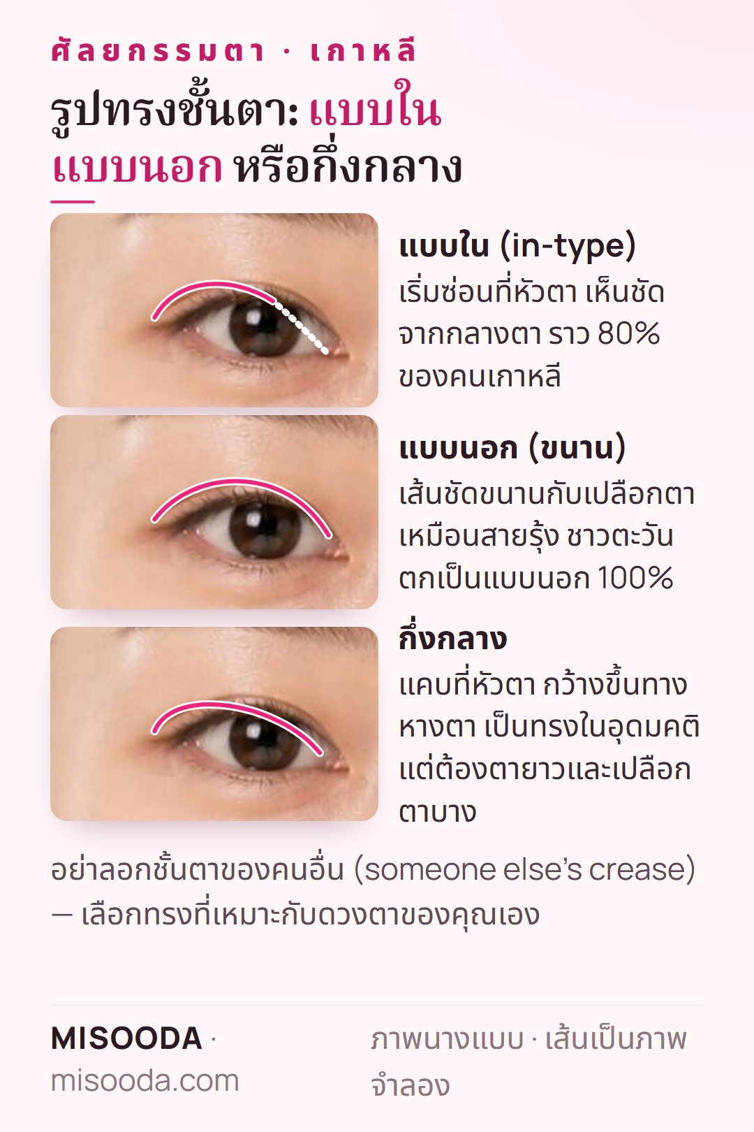 รูปทรงชั้นตาสองชั้น: แบบใน (ราว 80% ของคนเกาหลี) แบบนอกขนาน (ชาวตะวันตกเป็นแบบนอก 100%) และแบบกึ่งกลาง