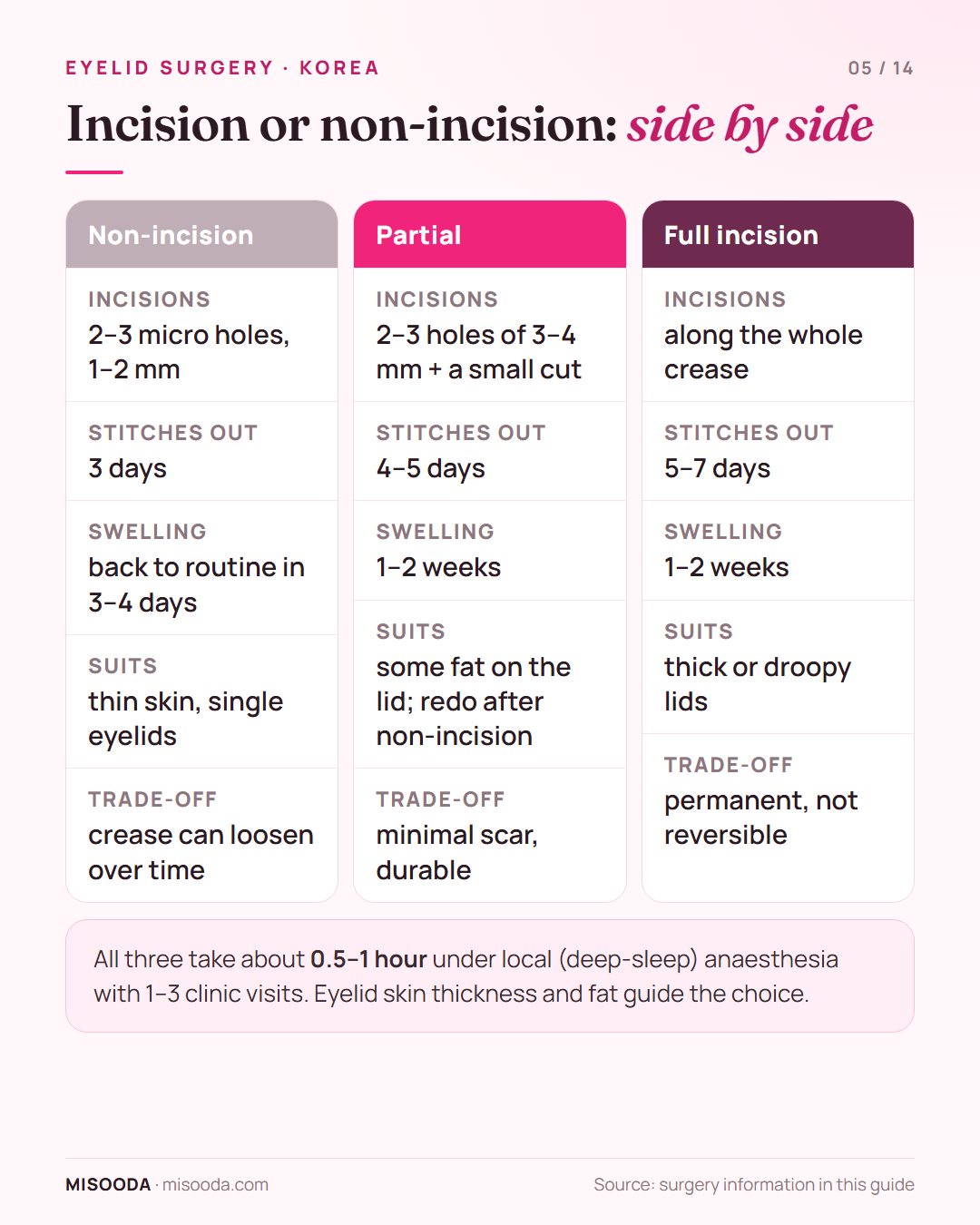 Double eyelid non-incision vs partial vs full incision compared: stitches out at 3, 4–5 and 5–7 days, swelling, who each suits and the trade-offs