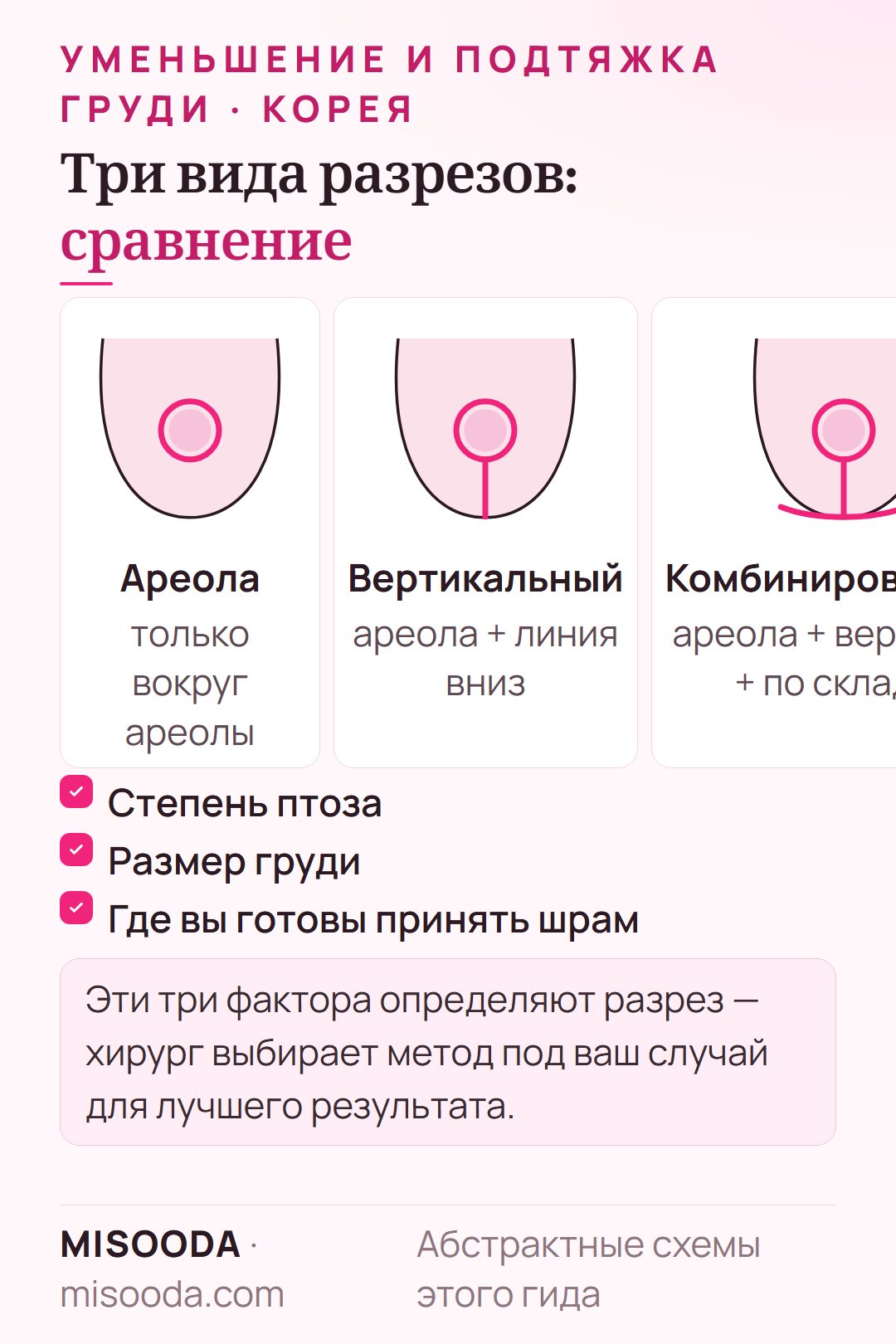 Разрезы при уменьшении и подтяжке груди в Корее: вокруг ареолы, вертикальный и комбинированный разрез вдоль субмаммарной складки