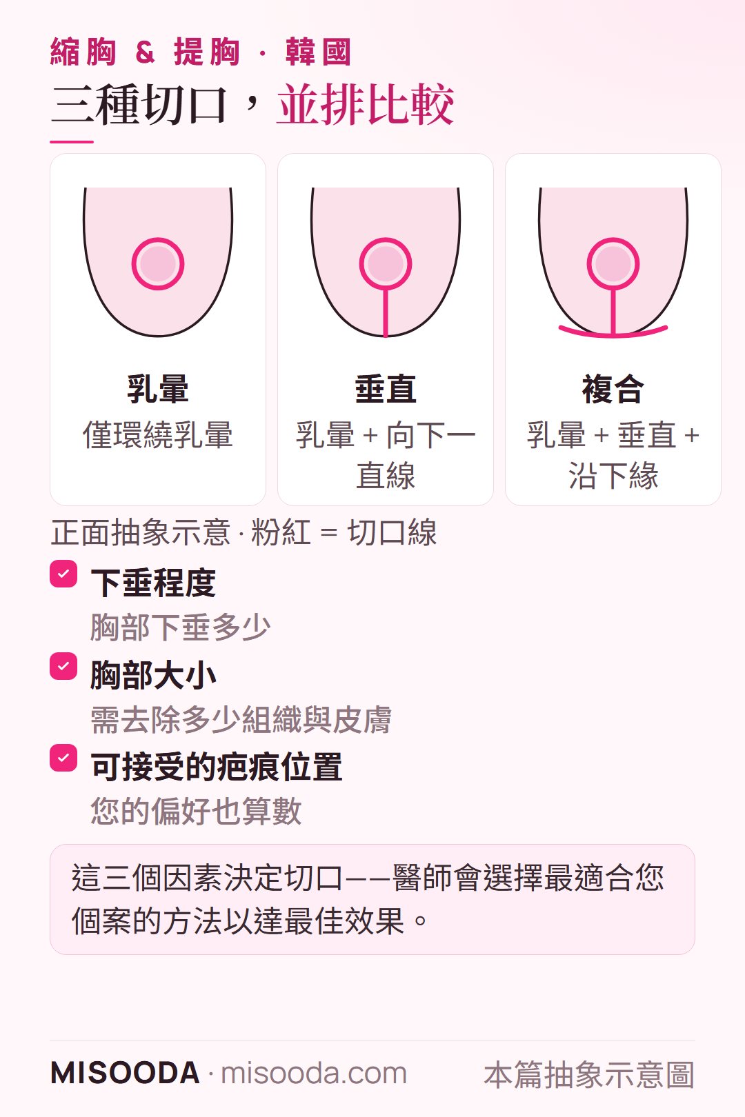 韓國 縮胸與提胸三種切口方式:僅環繞乳暈的乳暈切口、向下一直線的垂直切口,以及沿乳房下緣的複合切口