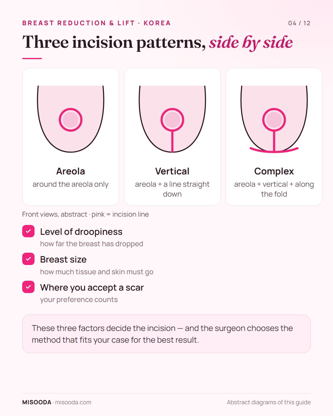 Breast reduction and lift incision patterns in Korea: areola incision, vertical incision and complex incision along the breast fold