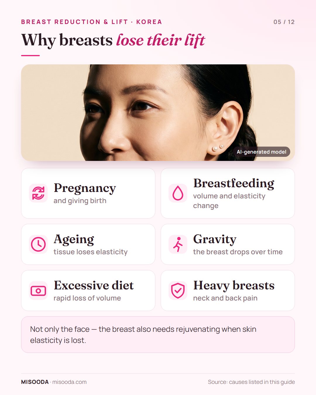Causes of sagging breasts: pregnancy, breastfeeding, ageing, gravity, excessive diet and large heavy breasts causing neck and back pain