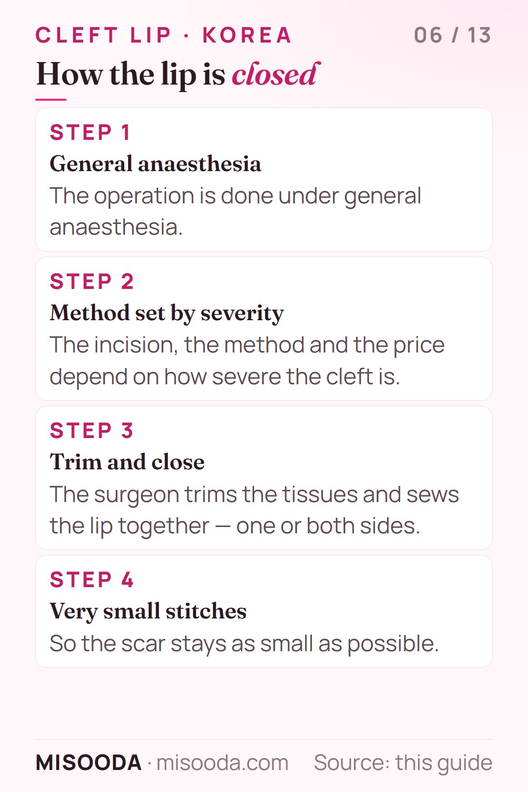 Cleft lip surgery procedure in four steps: general anaesthesia, method chosen by severity, tissues trimmed and the lip sewn together, very small stitches to minimise scarring