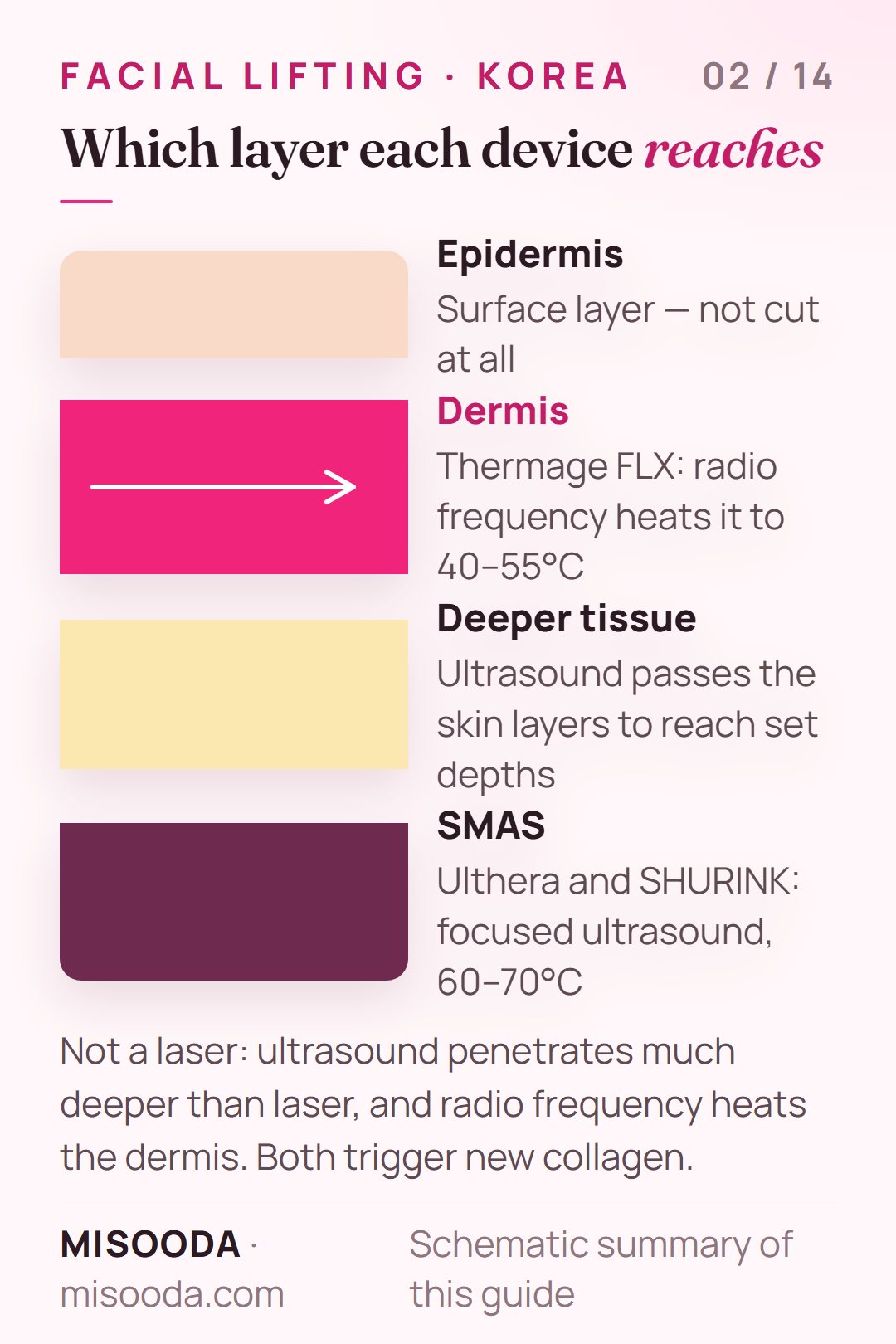 Facial lifting energy depth: Thermage FLX radio frequency heats the dermis to 40–55°C, Ulthera and SHURINK focused ultrasound reach the SMAS at 60–70°C