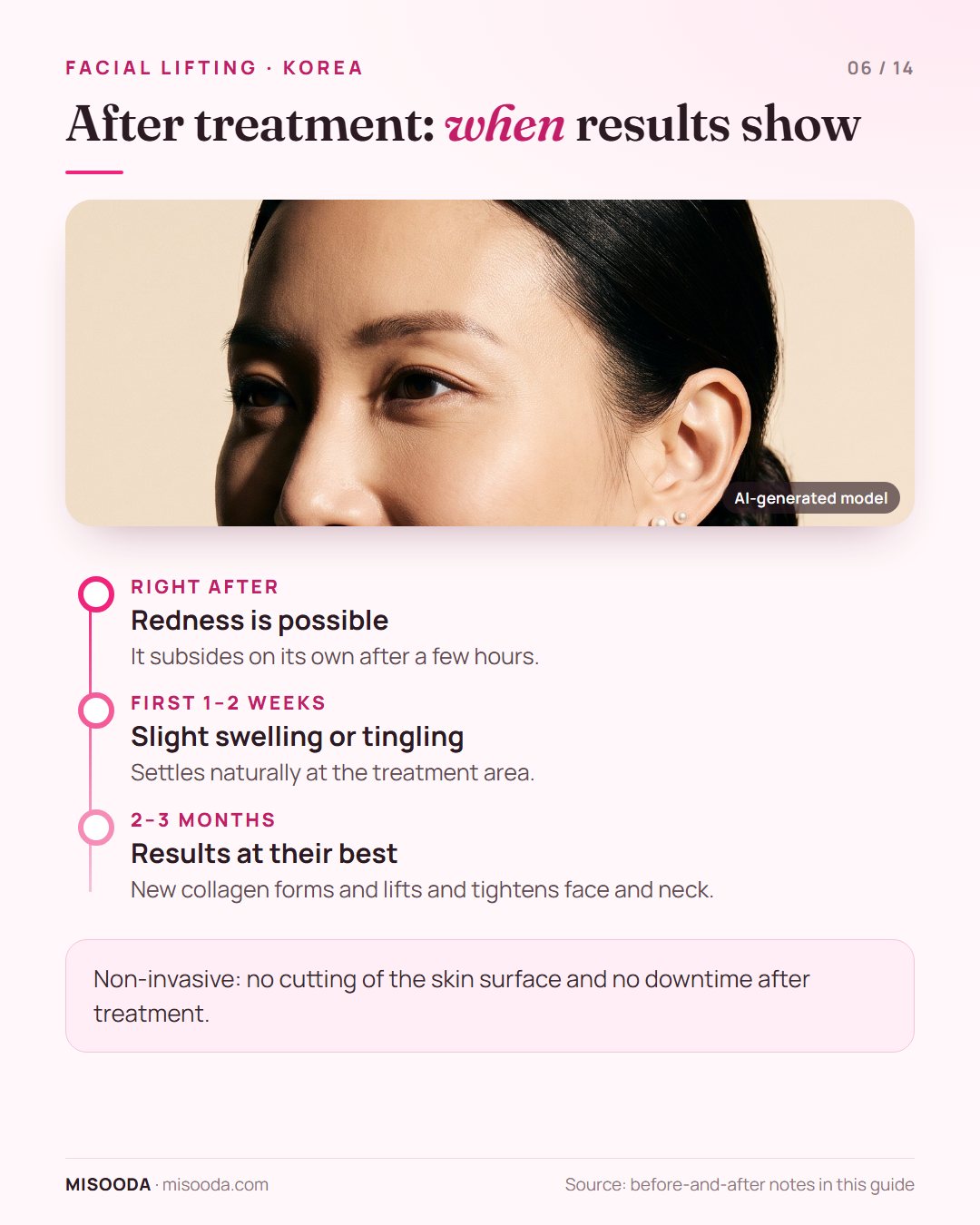 Facial lifting results timeline: redness fades in a few hours, slight swelling or tingling settles in 1–2 weeks, best results at 2–3 months as collagen forms