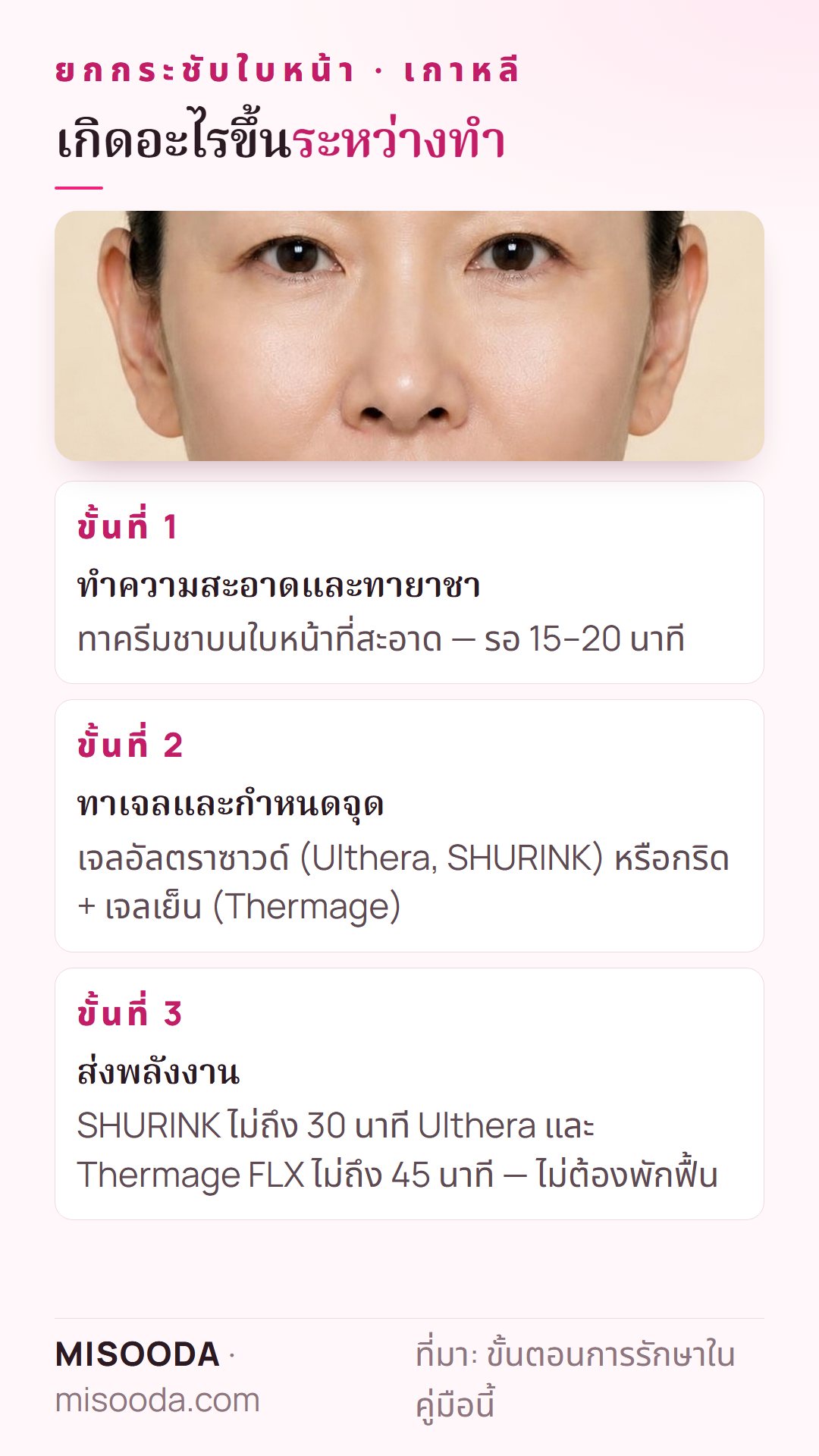 ขั้นตอนยกกระชับใบหน้าในเกาหลี: ครีมชา 15–20 นาที ทาเจลและกำหนดจุด แล้วส่งพลังงานไม่ถึง 30–45 นาที ไม่ต้องพักฟื้น