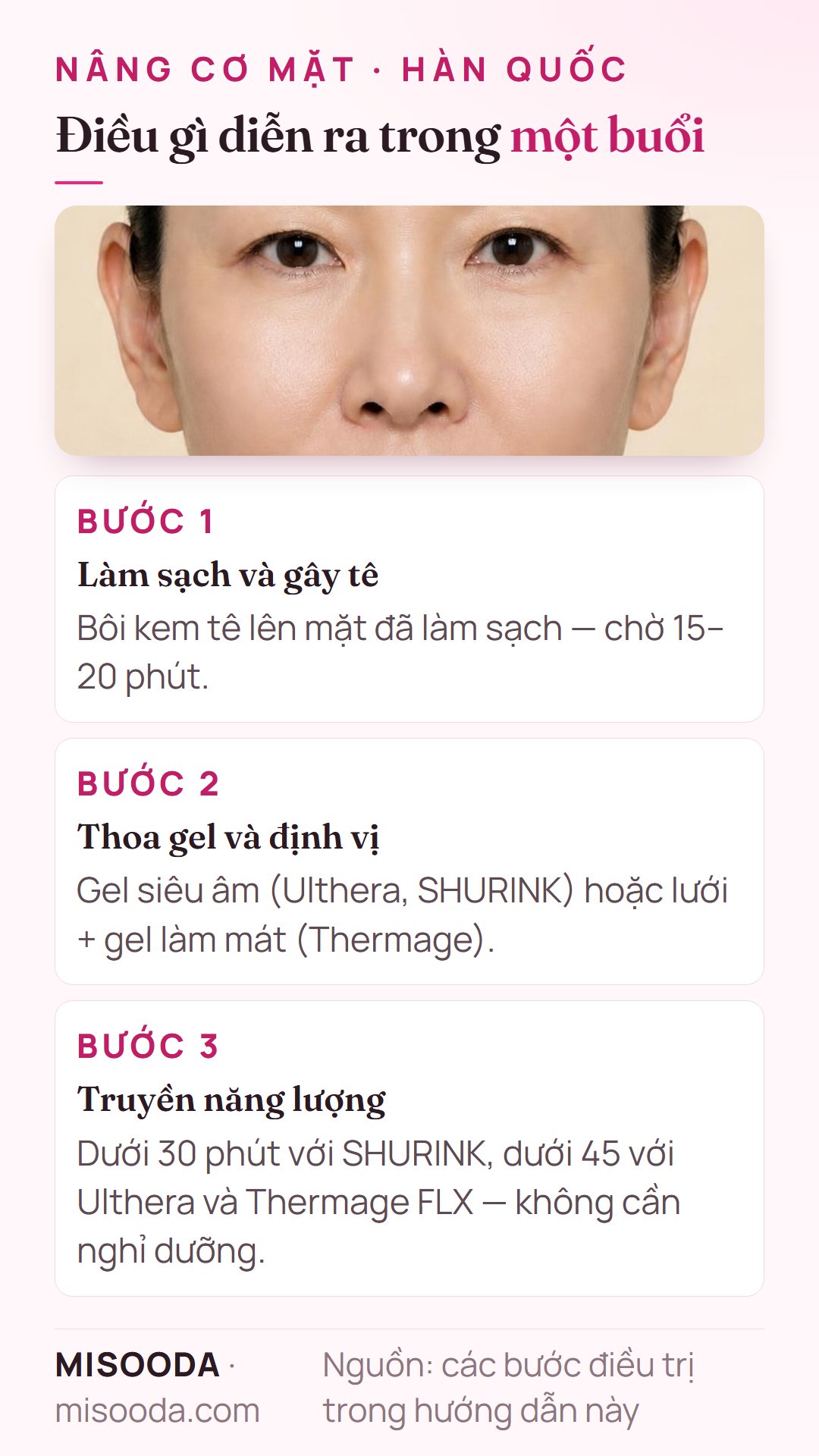 Các bước một buổi nâng cơ mặt tại Hàn Quốc: kem tê 15–20 phút, thoa gel và định vị, rồi truyền năng lượng dưới 30–45 phút, không cần nghỉ dưỡng