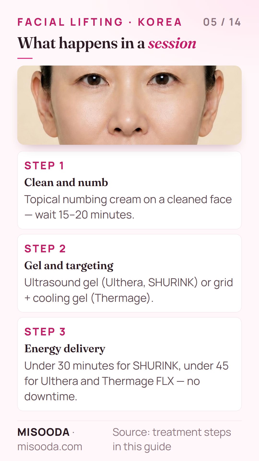 Facial lifting session steps in Korea: numbing cream for 15–20 minutes, gel and targeting, then energy delivery in under 30–45 minutes with no downtime