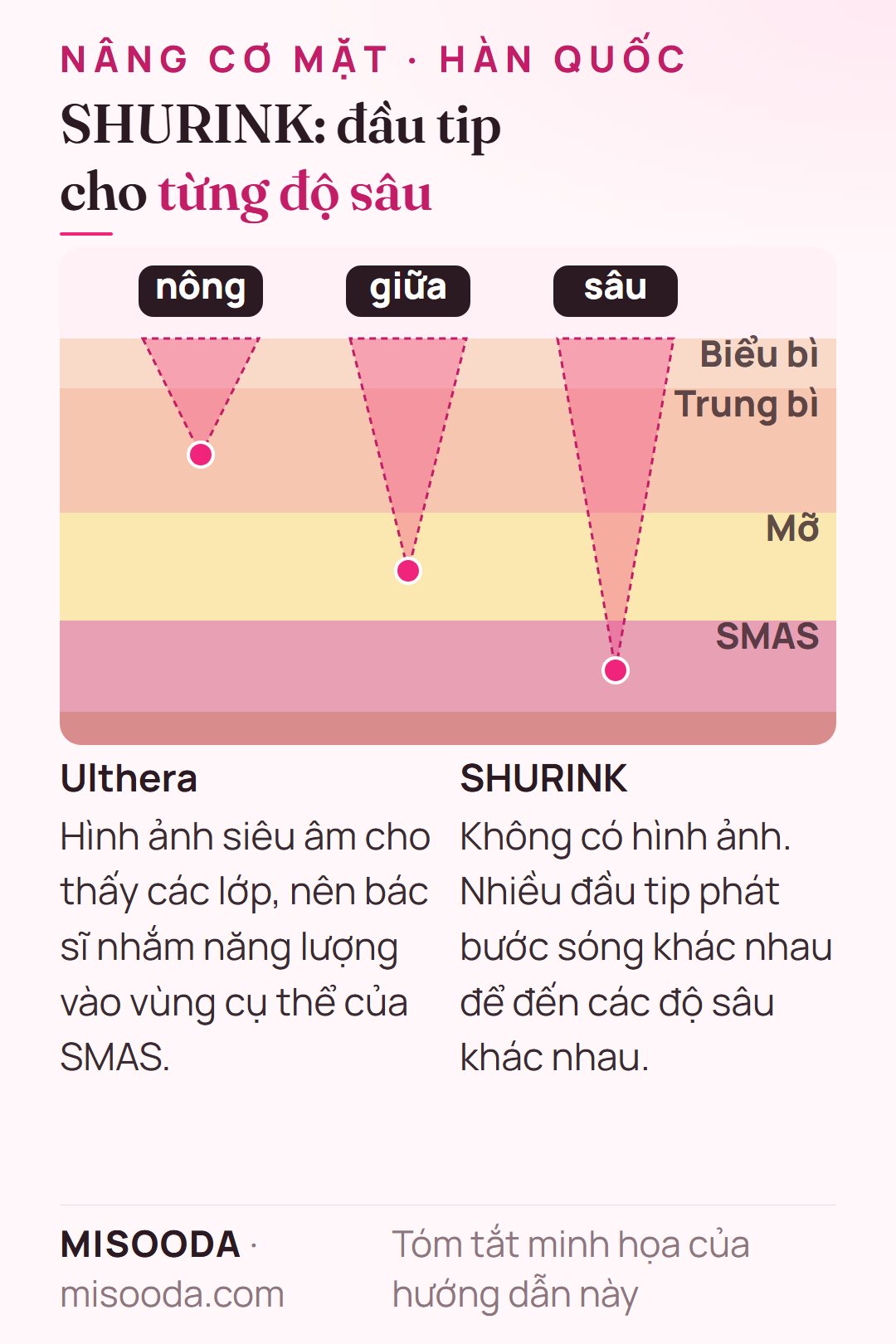 Cách định vị SHURINK và Ulthera: đầu tip SHURINK phát bước sóng khác nhau đến lớp nông, giữa và sâu, còn Ulthera dùng hình ảnh siêu âm