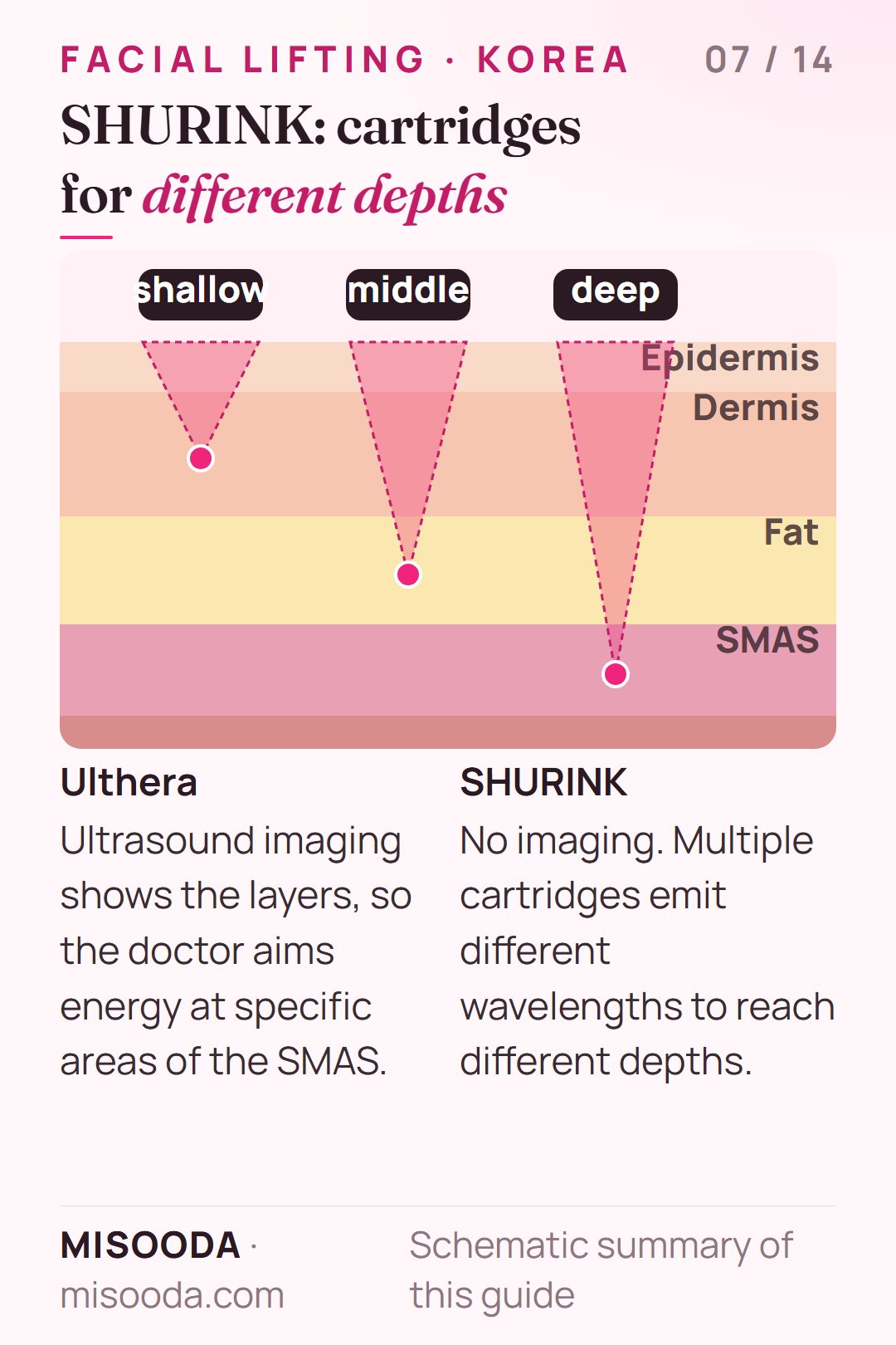 SHURINK vs Ulthera targeting: SHURINK cartridges emit different wavelengths to reach shallow, middle and deep layers while Ulthera uses ultrasound imaging