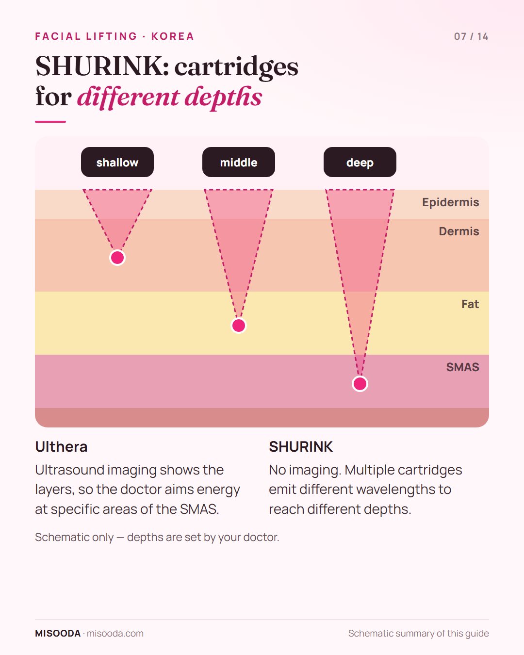 SHURINK vs Ulthera targeting: SHURINK cartridges emit different wavelengths to reach shallow, middle and deep layers while Ulthera uses ultrasound imaging