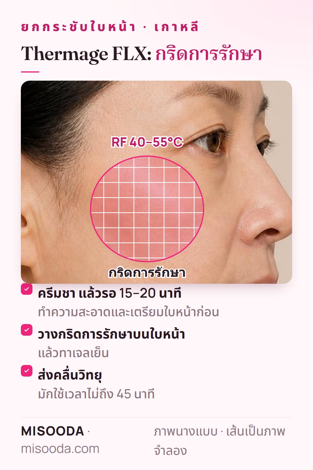 ทำ Thermage FLX ที่แก้ม: ครีมชา 15–20 นาที วางกริดและทาเจลเย็น แล้วส่งคลื่นวิทยุ 40–55°C ไม่ถึง 45 นาที