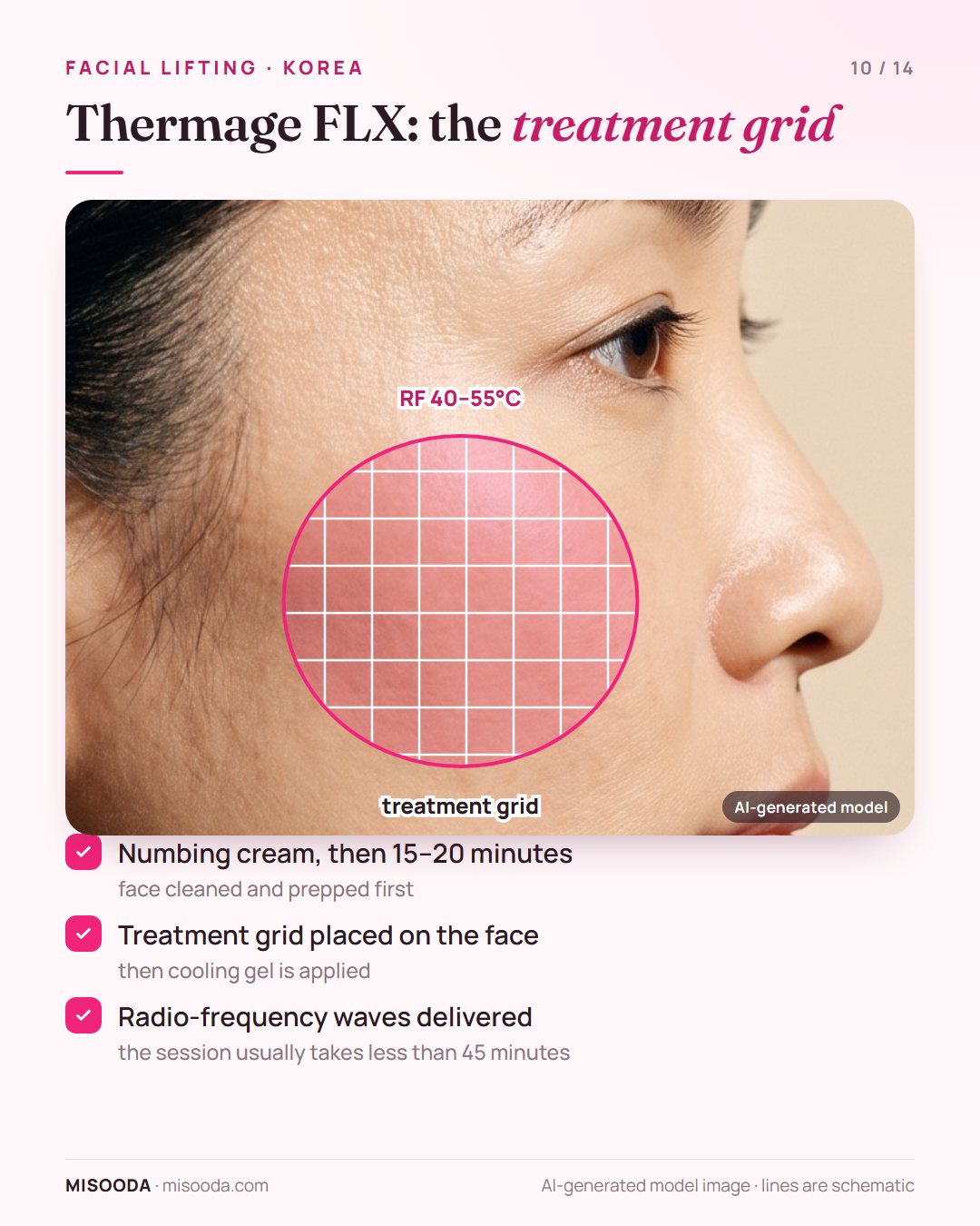 Thermage FLX treatment on the cheek: numbing cream for 15–20 minutes, a treatment grid and cooling gel, then radio frequency at 40–55°C in under 45 minutes