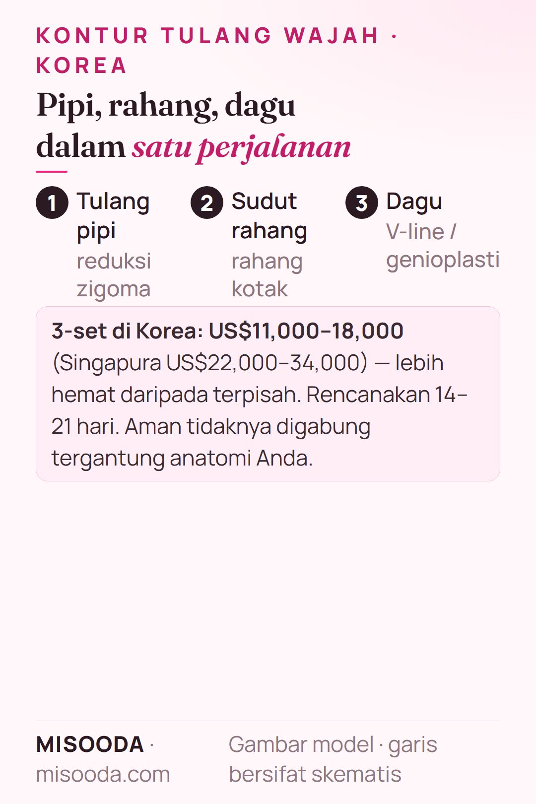 Kontur wajah 3-set di Korea dalam satu perjalanan: tulang pipi, sudut rahang dan dagu sekaligus US$11,000–18,000 vs US$22,000–34,000 di Singapura, tinggal 14–21 hari