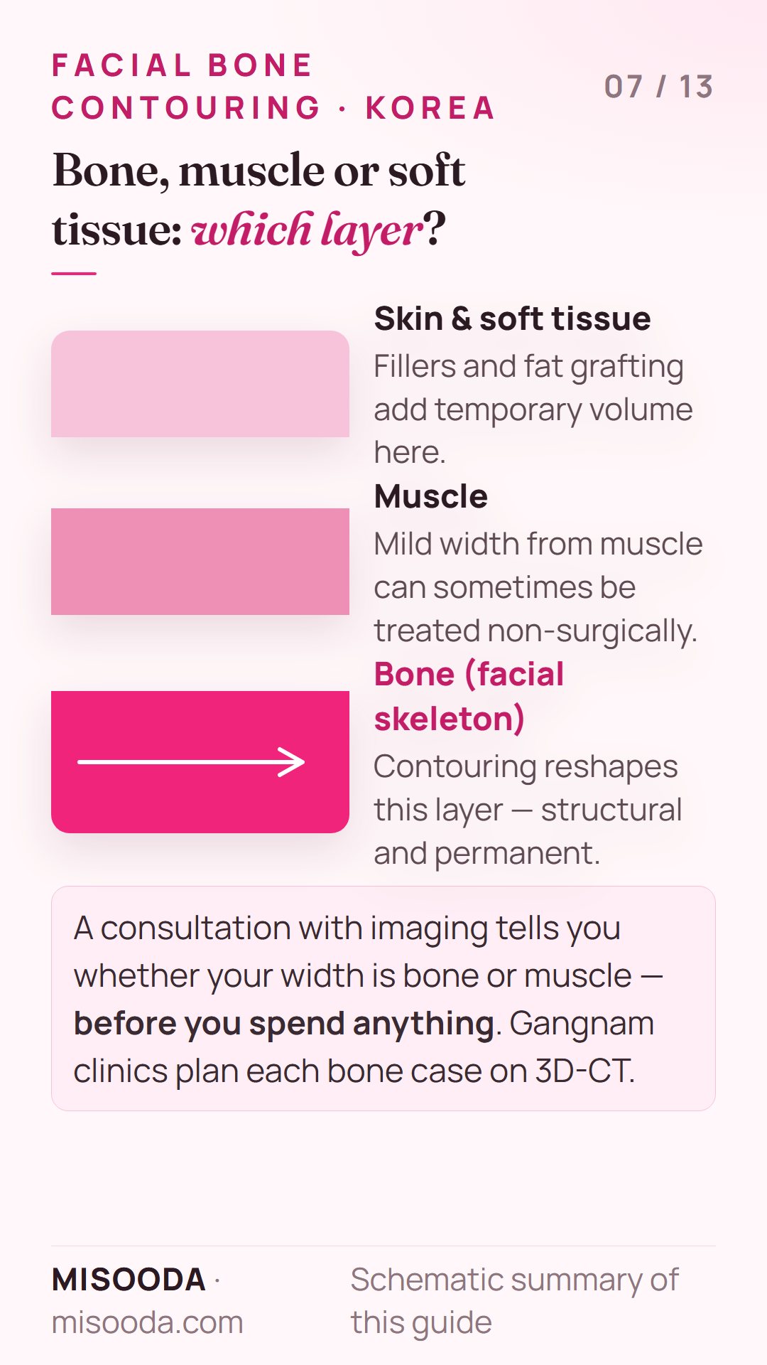 Facial bone contouring vs fillers: fillers and fat grafting add temporary volume on top, contouring reshapes the bone layer permanently, muscle width may be non-surgical