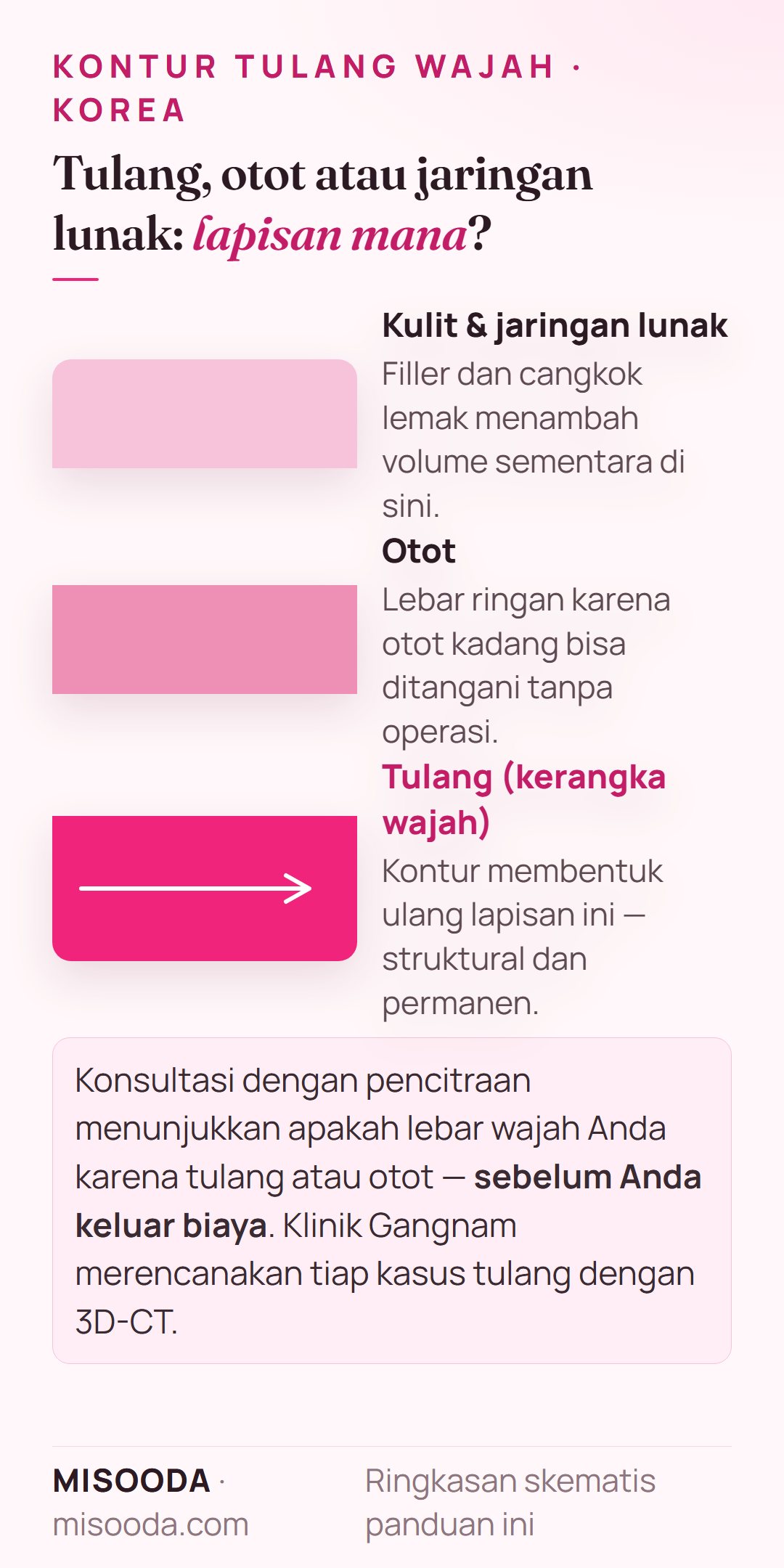 Kontur tulang wajah vs filler: filler dan cangkok lemak menambah volume sementara di atas, kontur membentuk lapisan tulang secara permanen, lebar otot bisa tanpa operasi