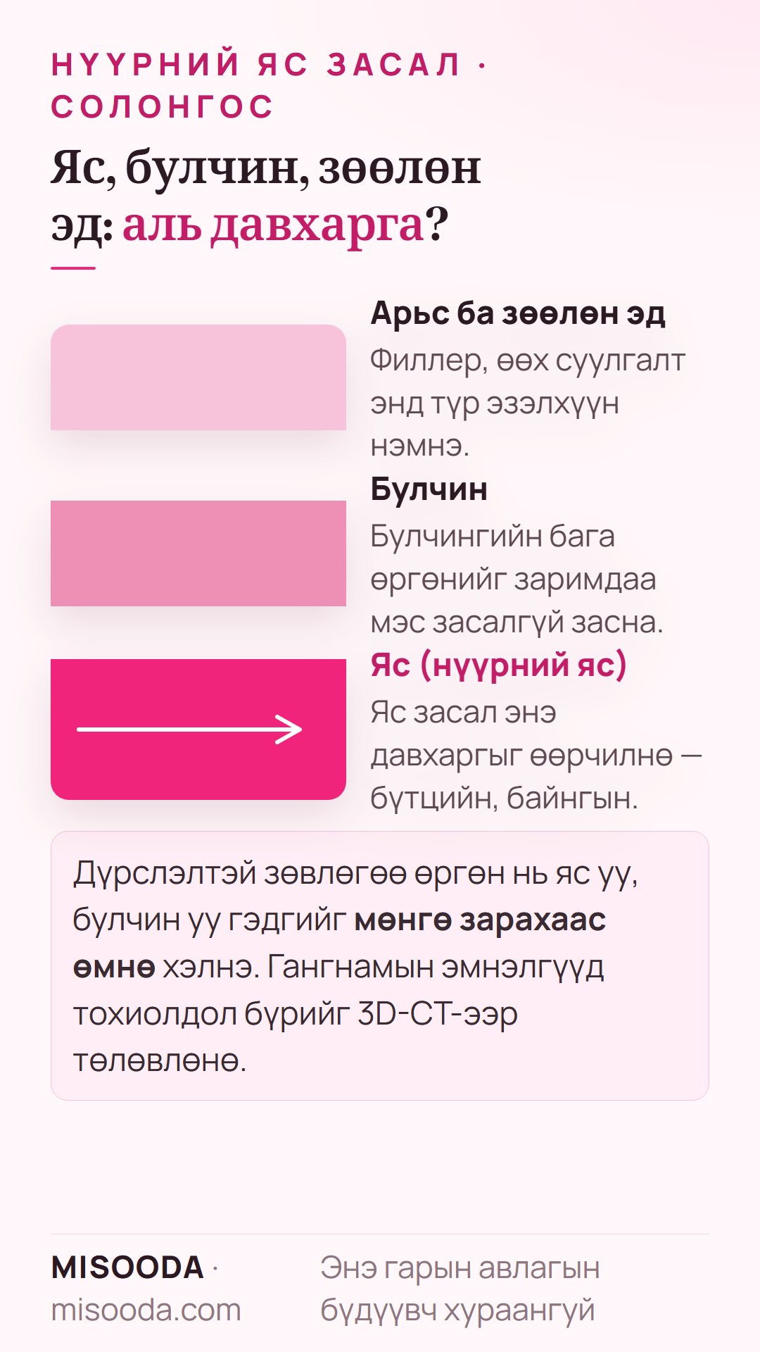 Нүүрний яс засал ба филлер: филлер, өөх суулгалт дээд талд түр эзэлхүүн нэмнэ, яс засал ясны давхаргыг байнга өөрчилнө, булчингийн өргөнийг мэс засалгүй засаж болно