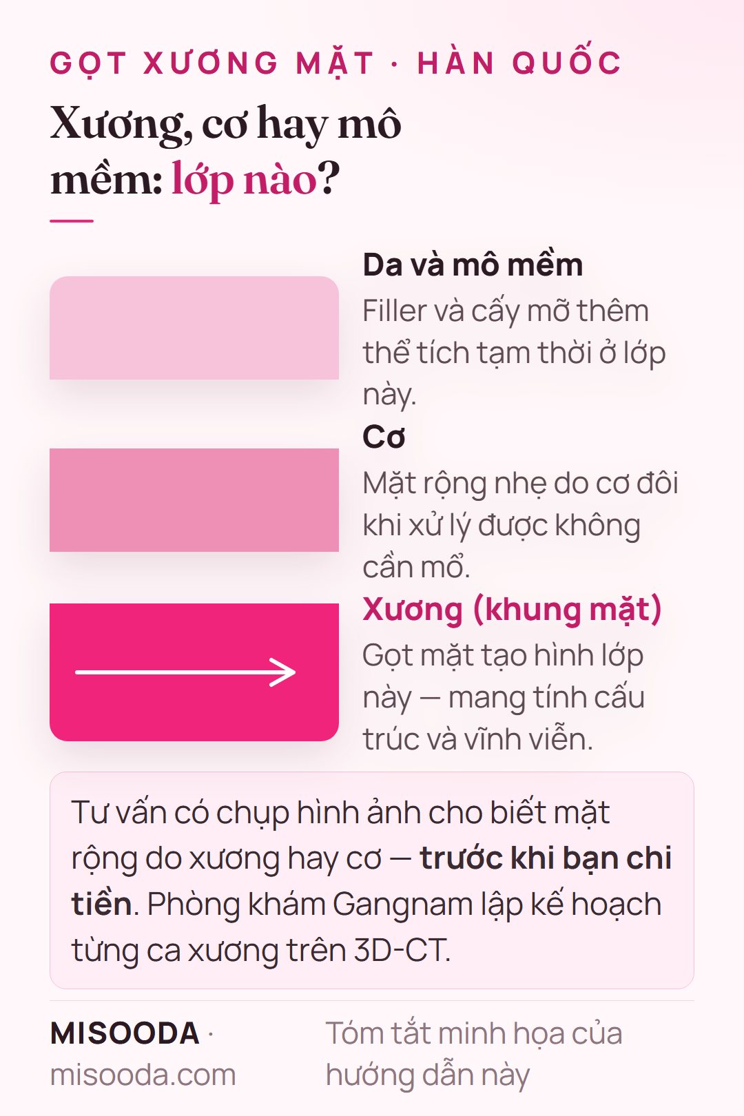 Gọt xương mặt và filler: filler và cấy mỡ thêm thể tích tạm thời ở lớp trên, gọt mặt tạo hình lớp xương vĩnh viễn, mặt rộng do cơ có thể không cần mổ