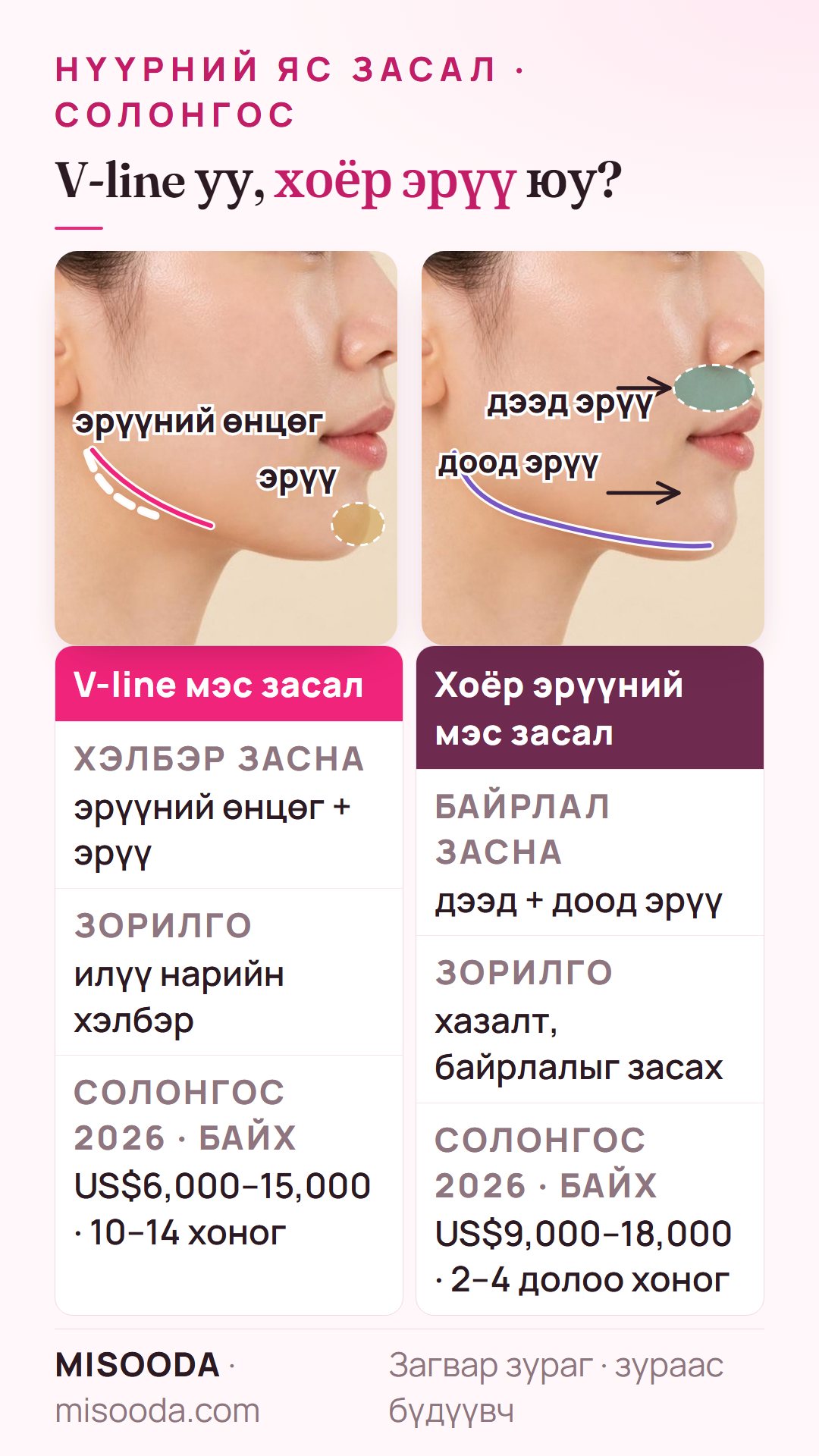 Хажуу төрхөөр V-line ба хоёр эрүүний мэс засал: V-line эрүүний өнцөг, эрүүг засна (US$6,000–15,000), хоёр эрүү хоёр эрүүний байрлалыг засна (US$9,000–18,000)
