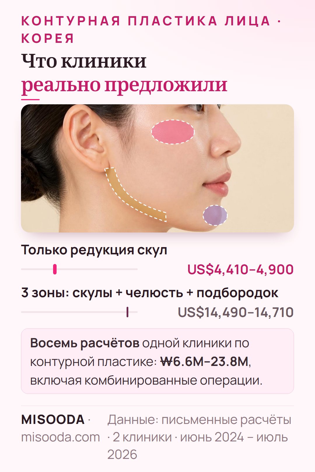 Реальные расчёты корейских клиник на контурную пластику лица 2024–2026: только редукция скул US$4,410–4,900, комплекс из 3 зон (скулы, челюсть и подбородок) US$14,490–14,710