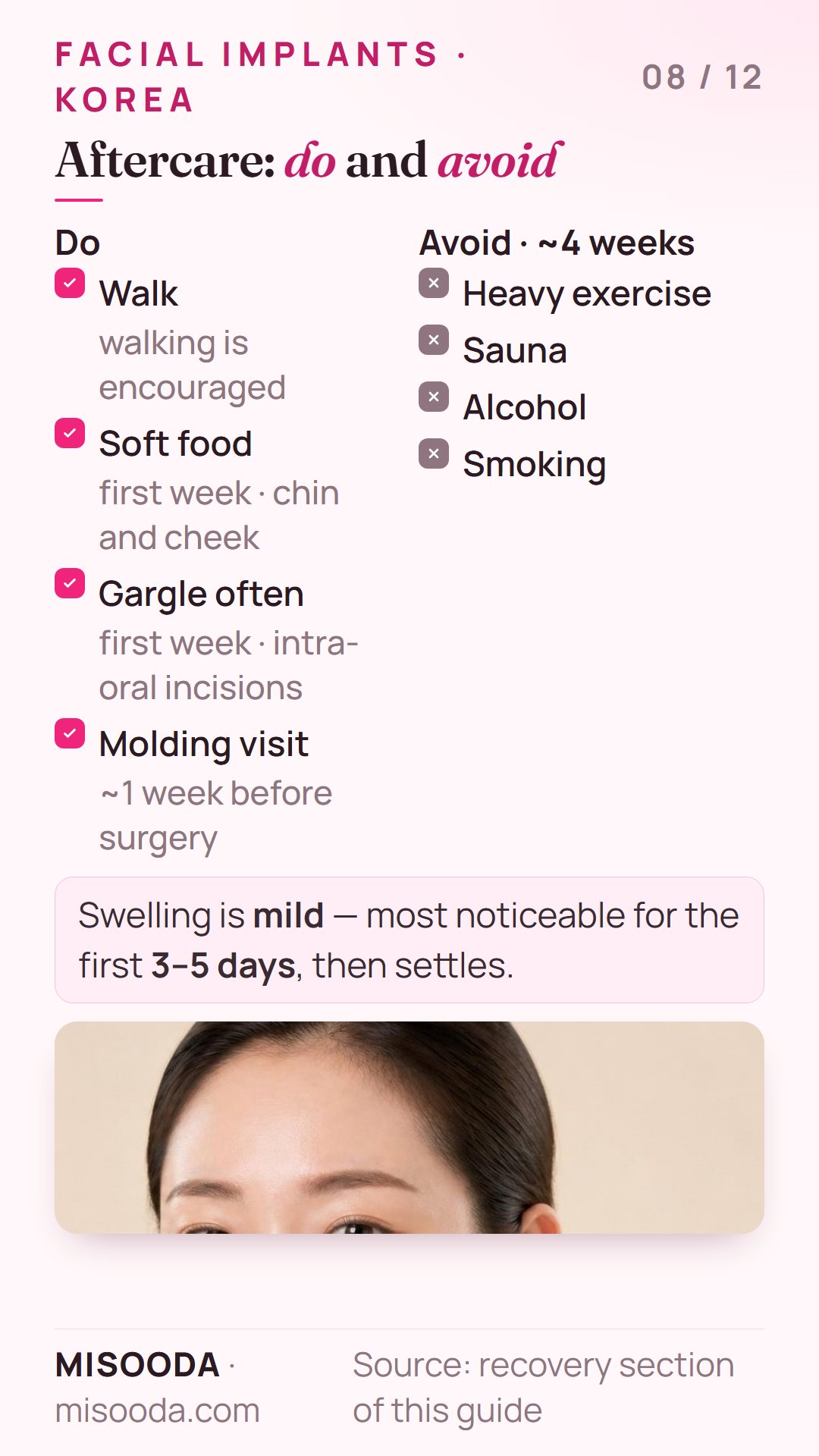 Facial implant aftercare: walking encouraged, soft food and frequent gargling for the first week; avoid heavy exercise, sauna, alcohol and smoking for 4 weeks