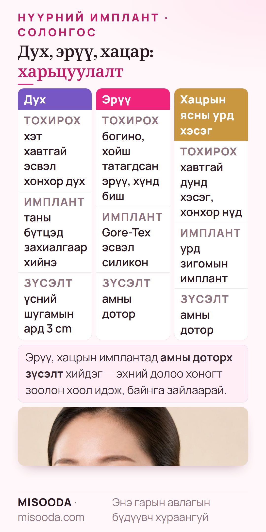 Нүүрний имплантын төрлүүдийн харьцуулалт: үсний шугамын ард 3 cm зүсэлттэй захиалгат духны имплант, Gore-Tex эсвэл силикон эрүүний имплант, урд зигомын имплант