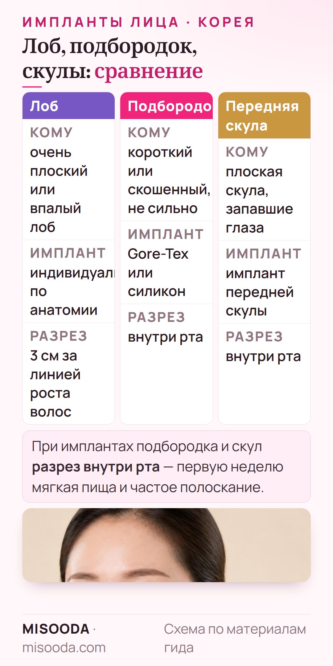 Сравнение имплантов лица: индивидуальный имплант лба через разрез 3 см за линией волос, имплант подбородка Gore-Tex или силикон, имплант передней скулы