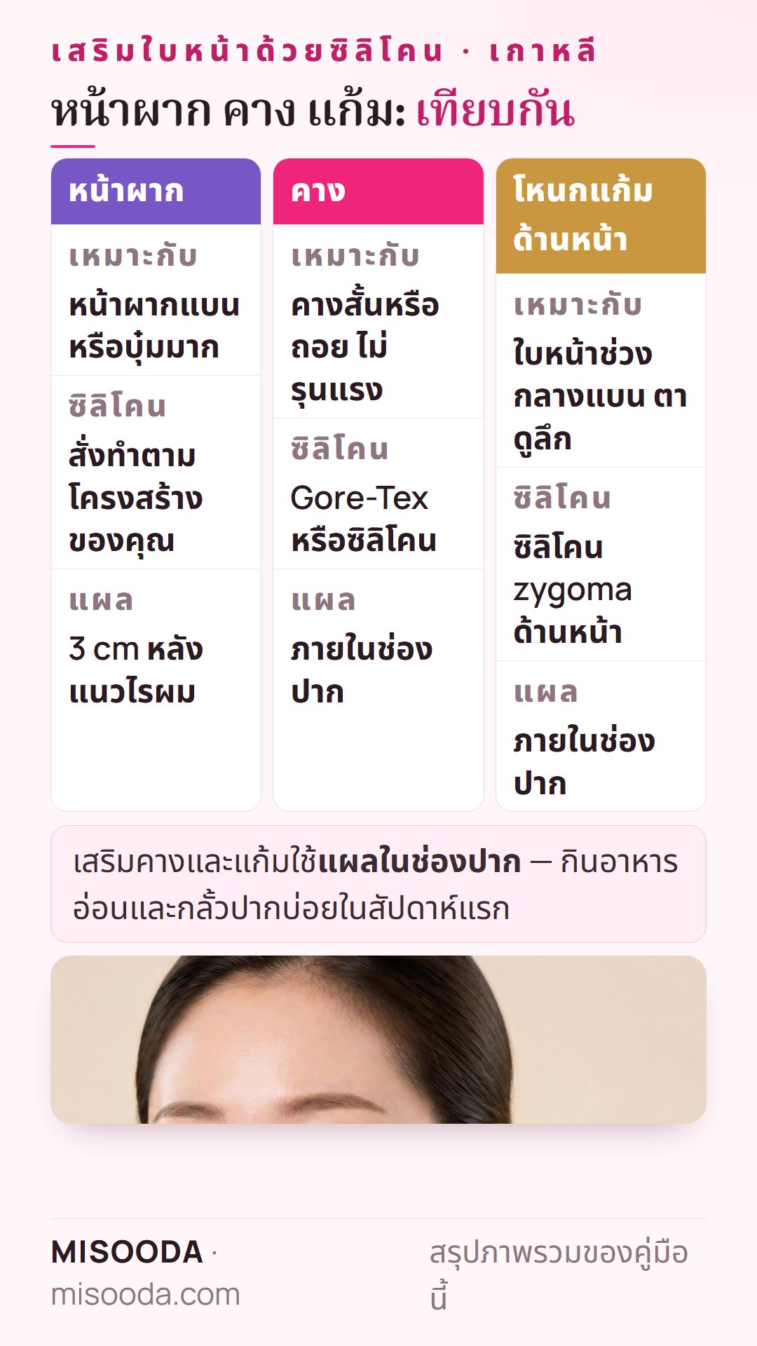เทียบประเภทการเสริมใบหน้า: หน้าผากซิลิโคนสั่งทำผ่านแผล 3 cm หลังแนวไรผม คางด้วย Gore-Tex หรือซิลิโคน และเสริม zygoma ด้านหน้า